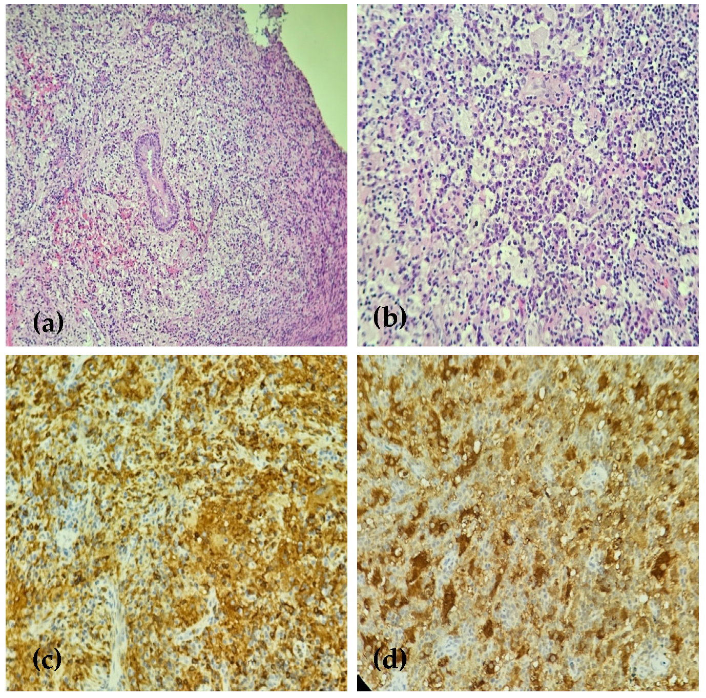Medicina 61 00585 g003