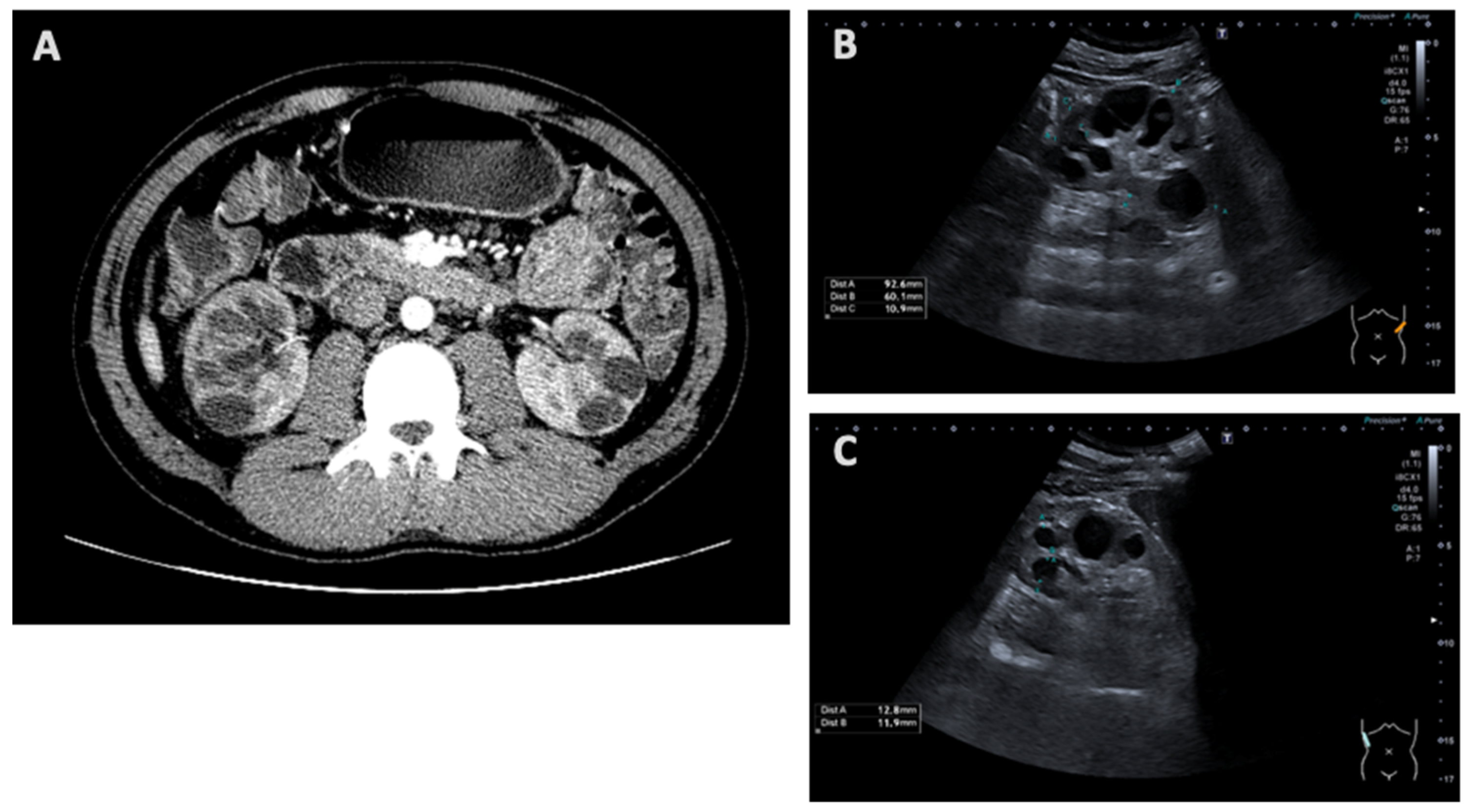 Medicina 61 00597 g001