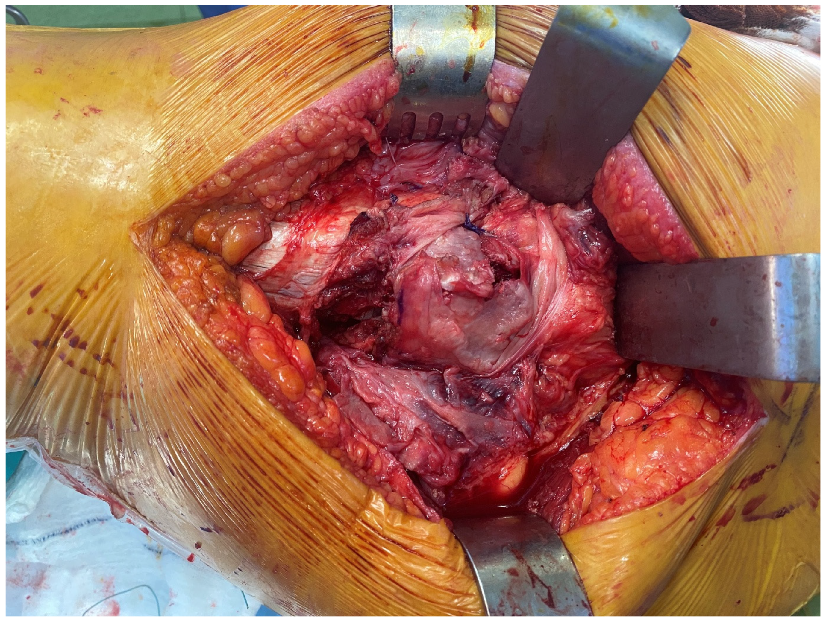 Medicina 61 00605 g004