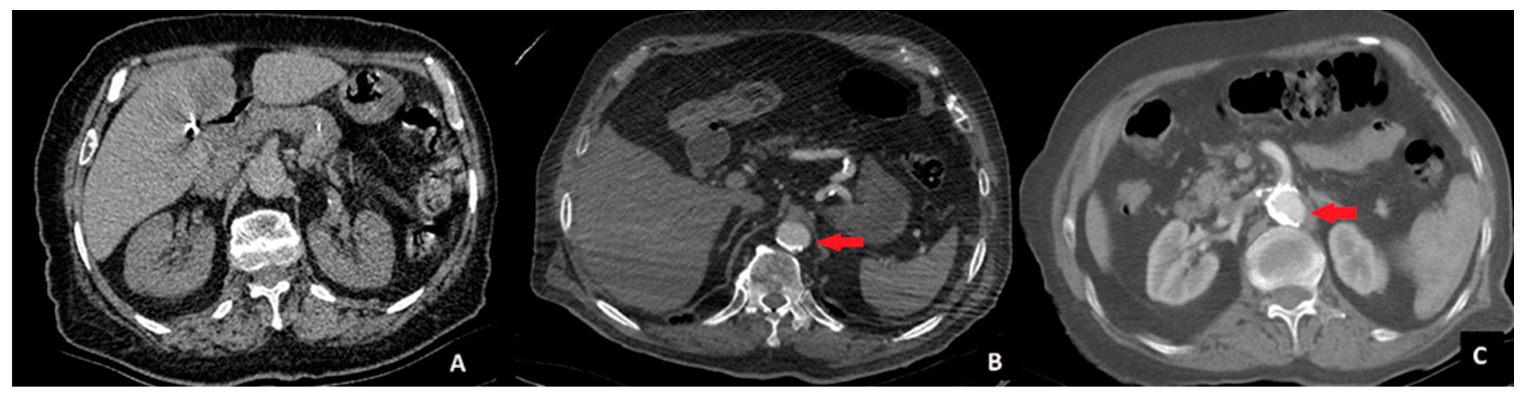 Medicina 61 00606 g001