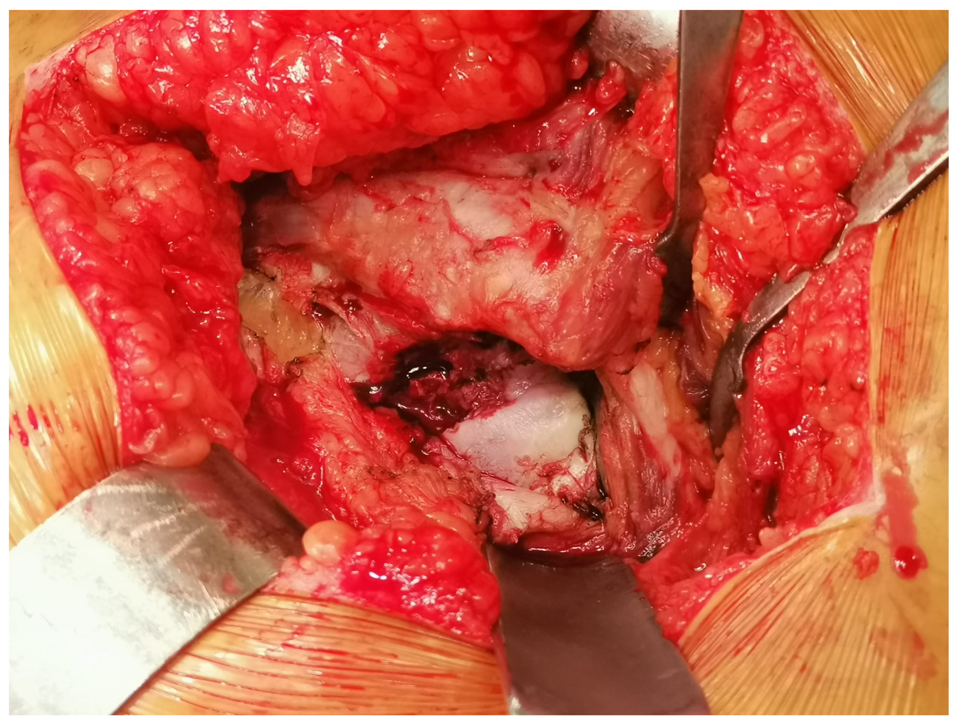 Medicina 61 00609 g001