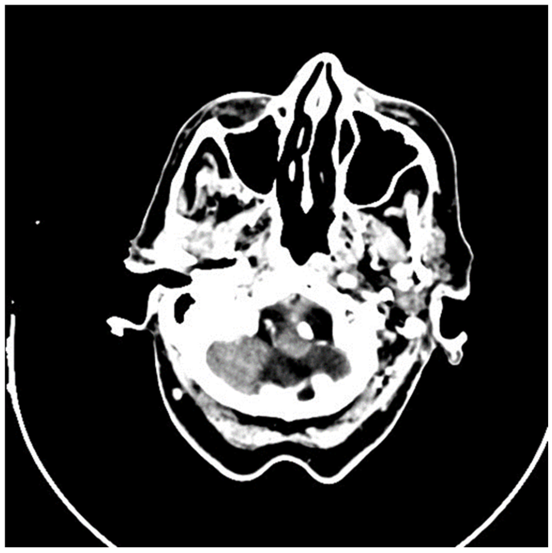 Medicina 61 00612 g001