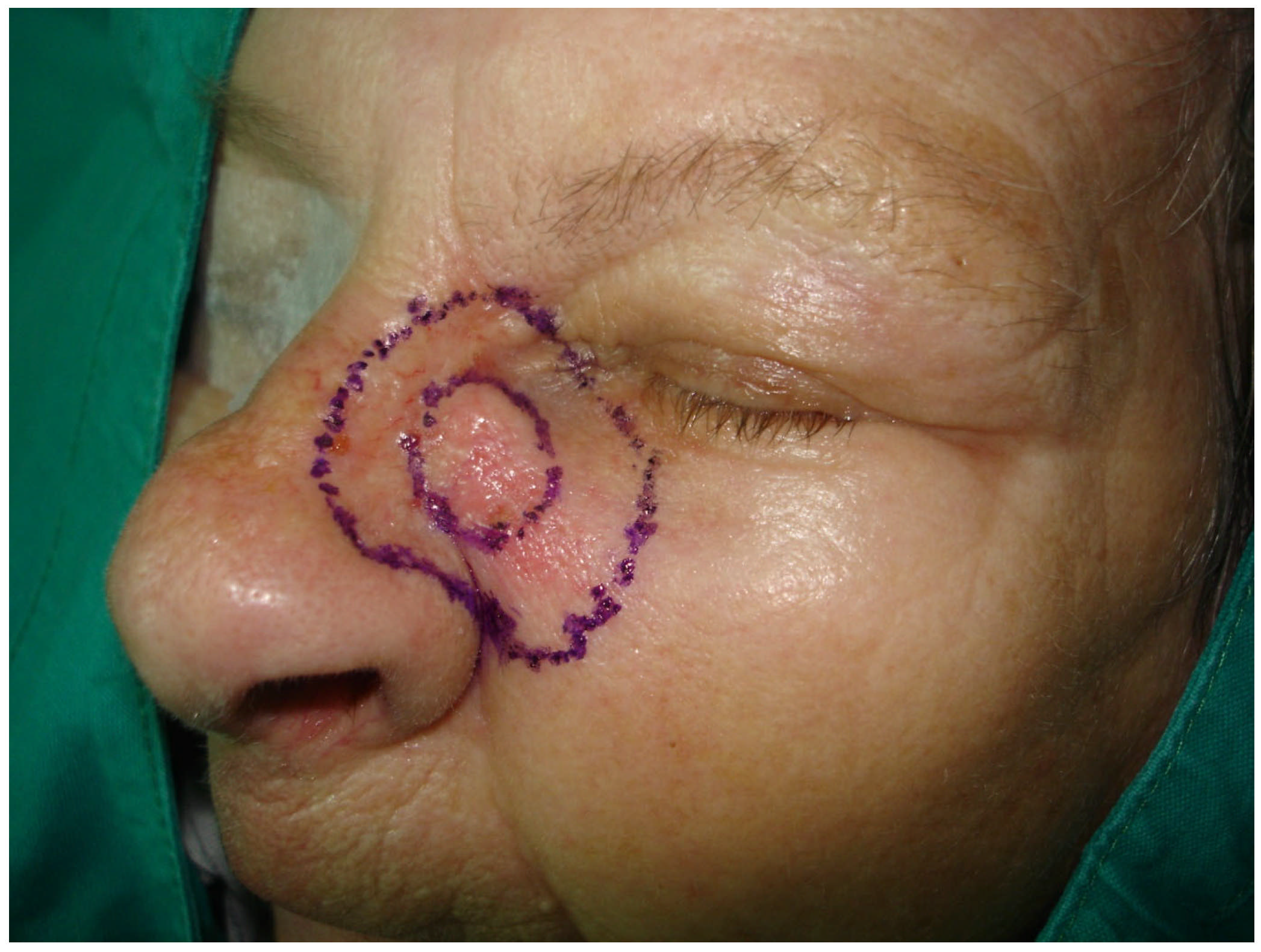 Medicina 61 00612 g002