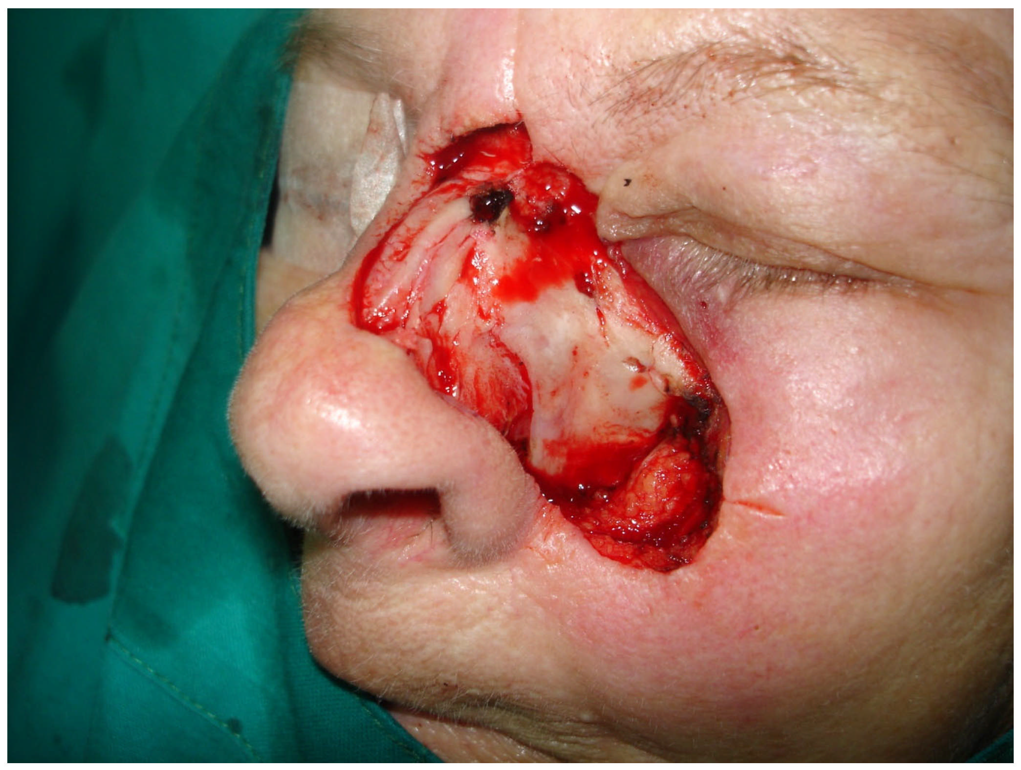 Medicina 61 00612 g003