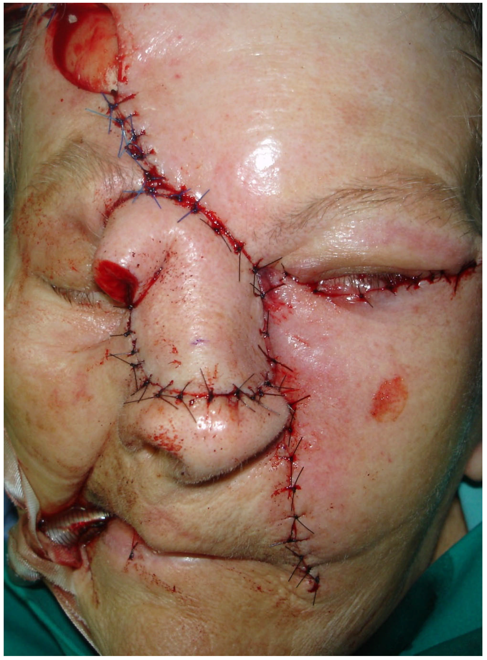 Medicina 61 00612 g004