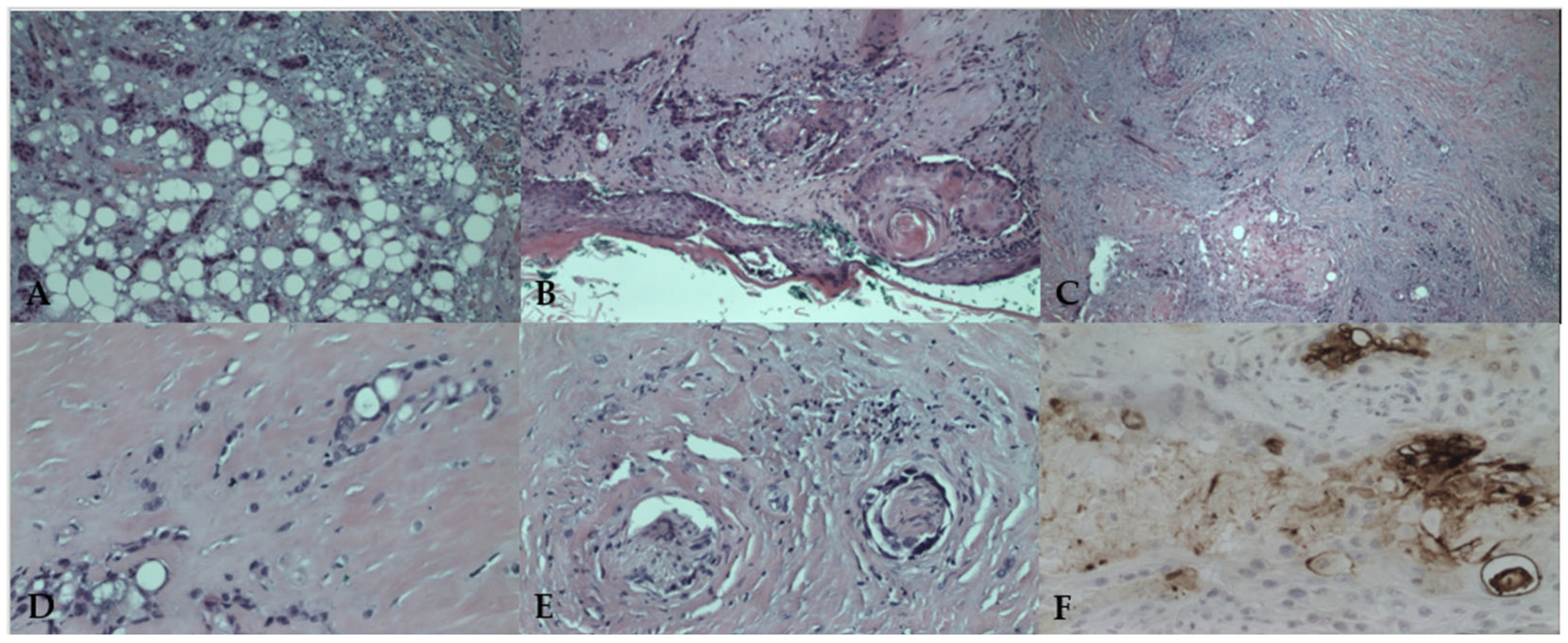 Medicina 61 00612 g005
