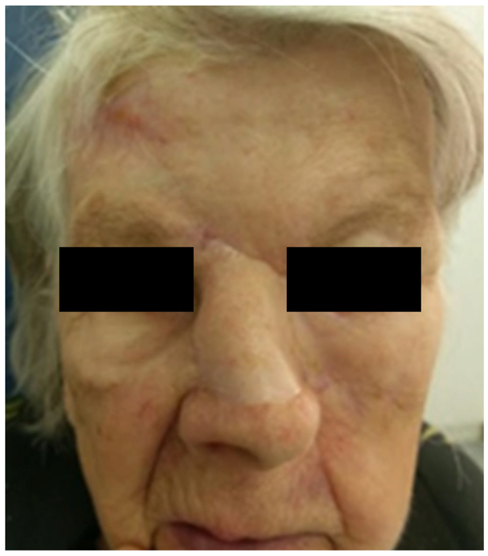 Medicina 61 00612 g006