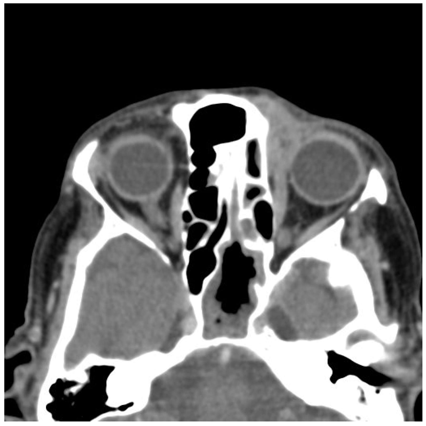 Medicina 61 00612 g007