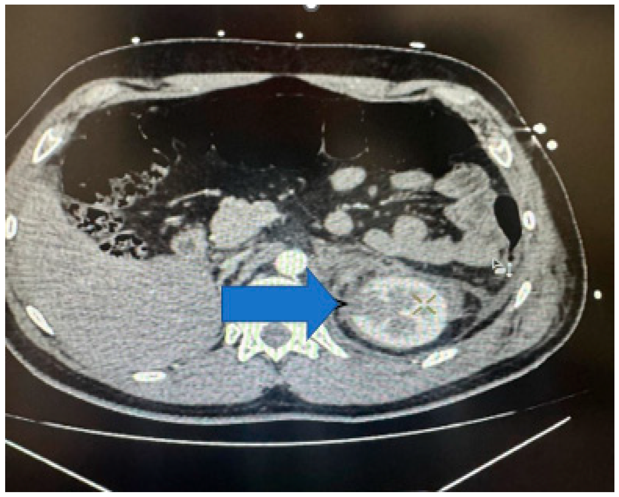 Medicina 61 00621 g008