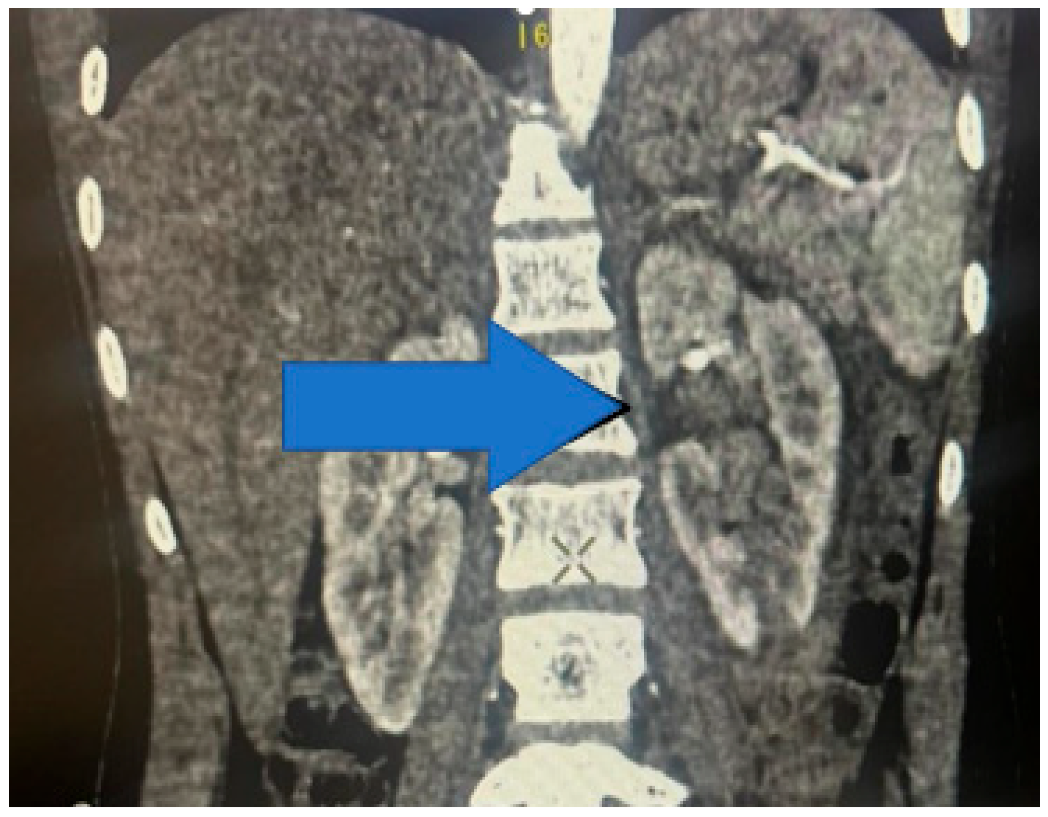 Medicina 61 00621 g009