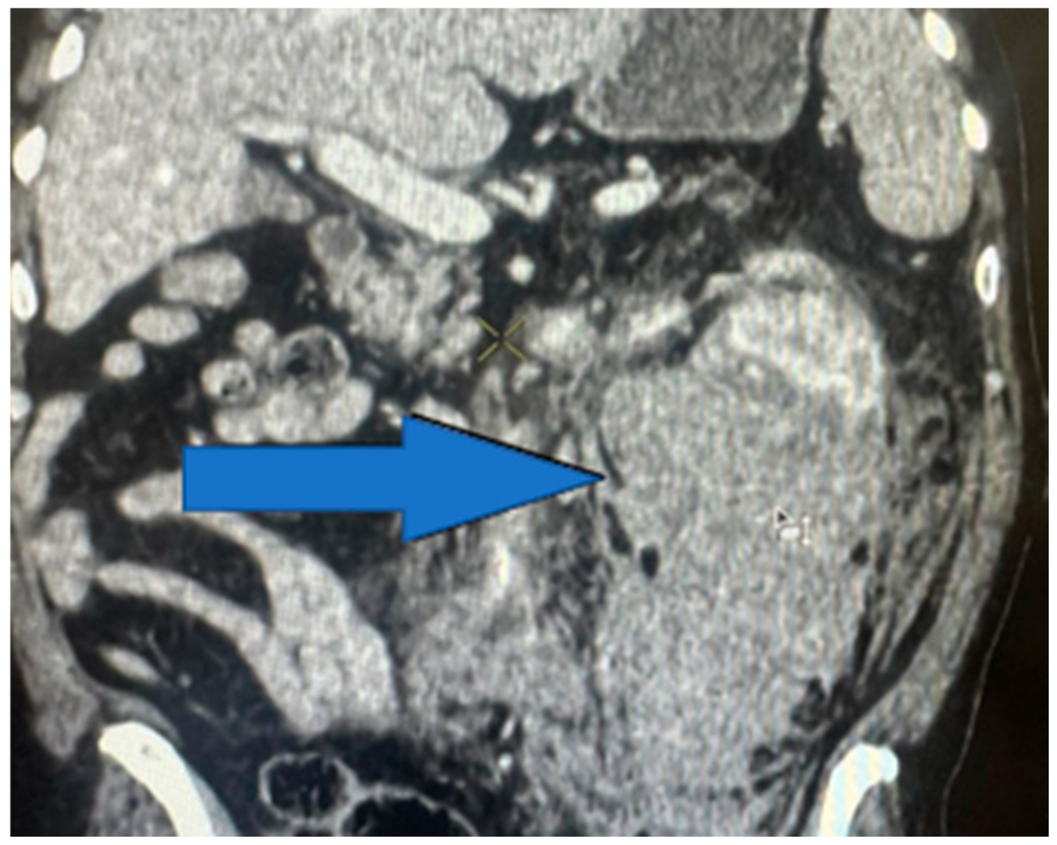 Medicina 61 00621 g011