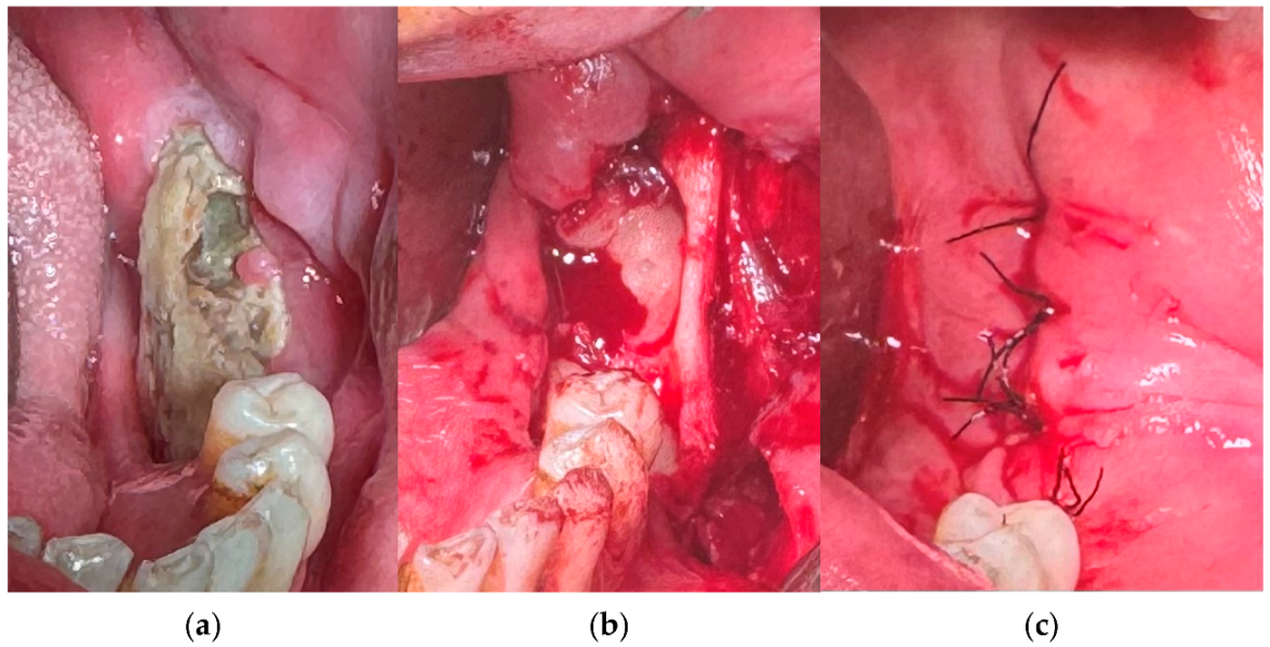 Medicina 61 00625 g004