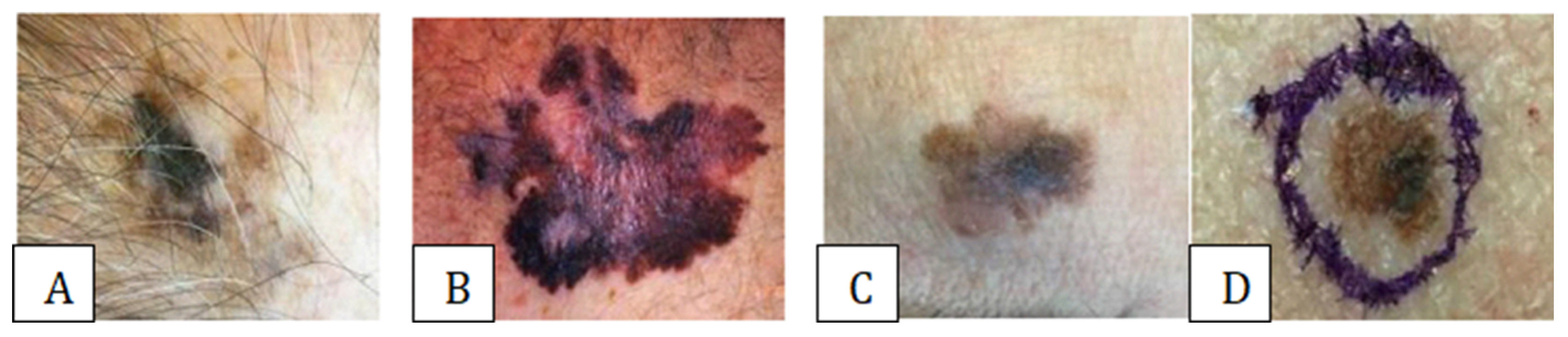 Medicina 61 00656 g001