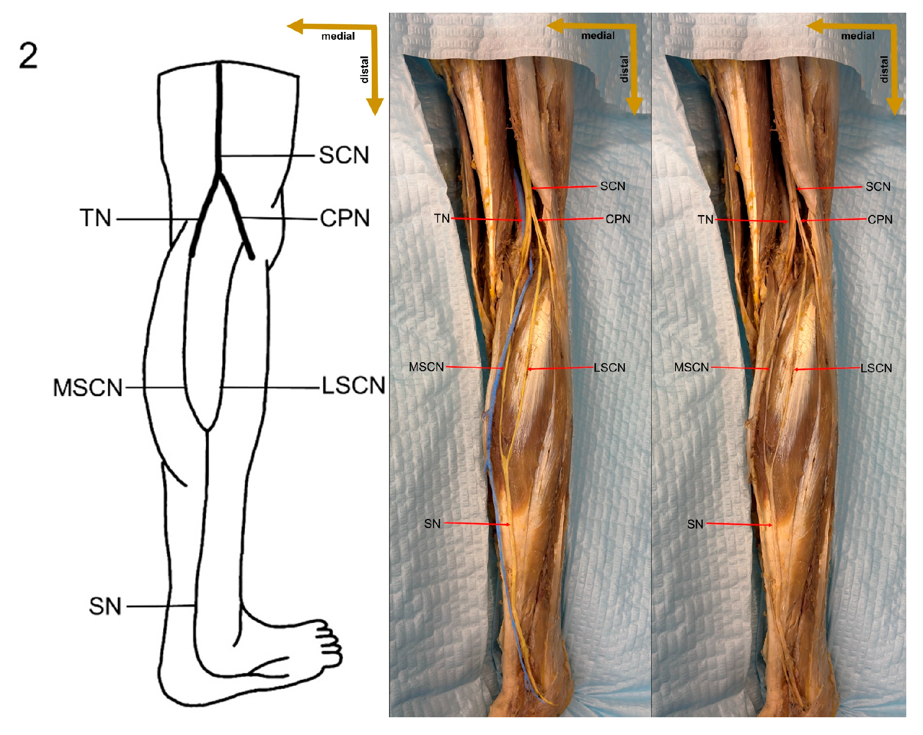 Medicina 61 00671 g005