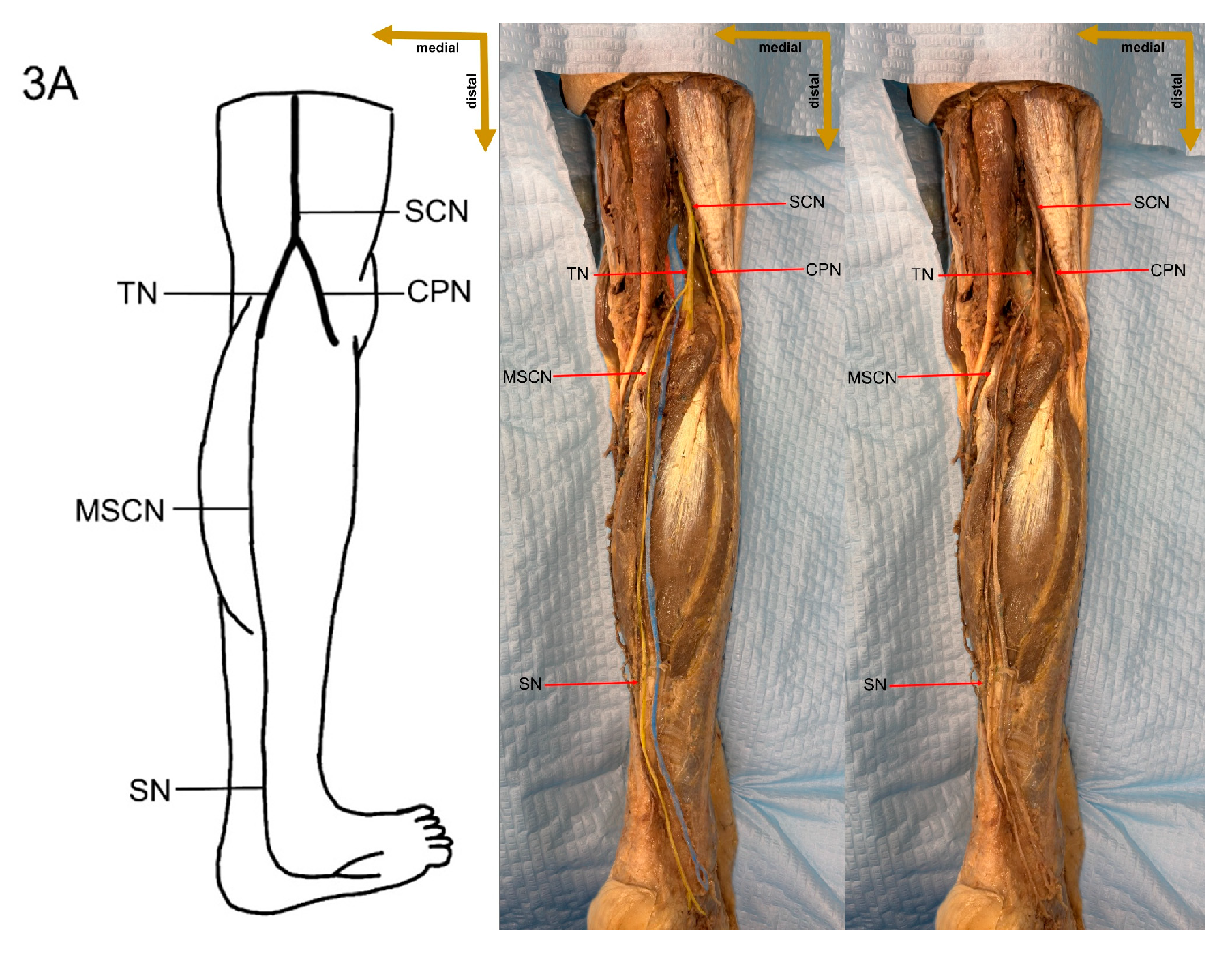 Medicina 61 00671 g006