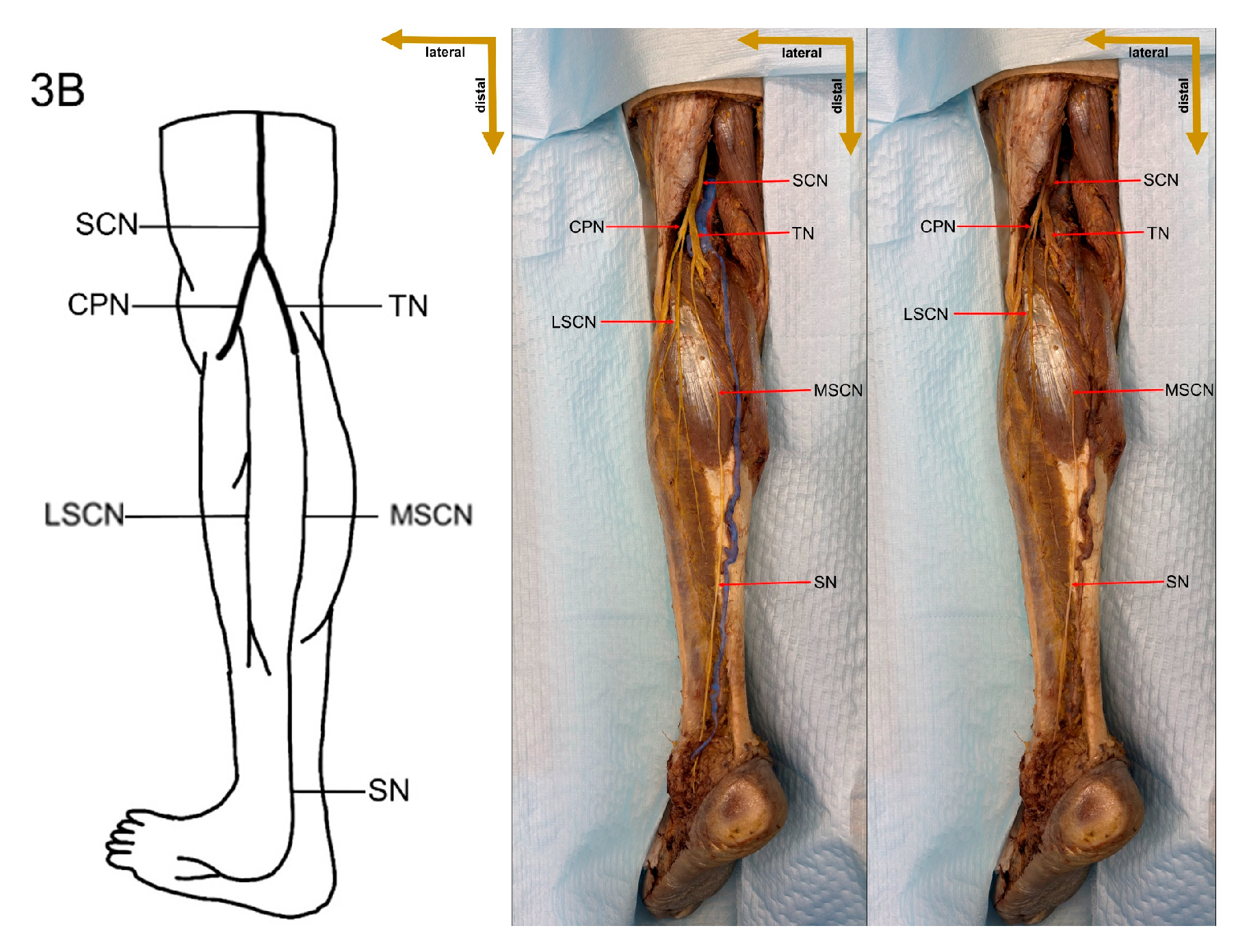 Medicina 61 00671 g007