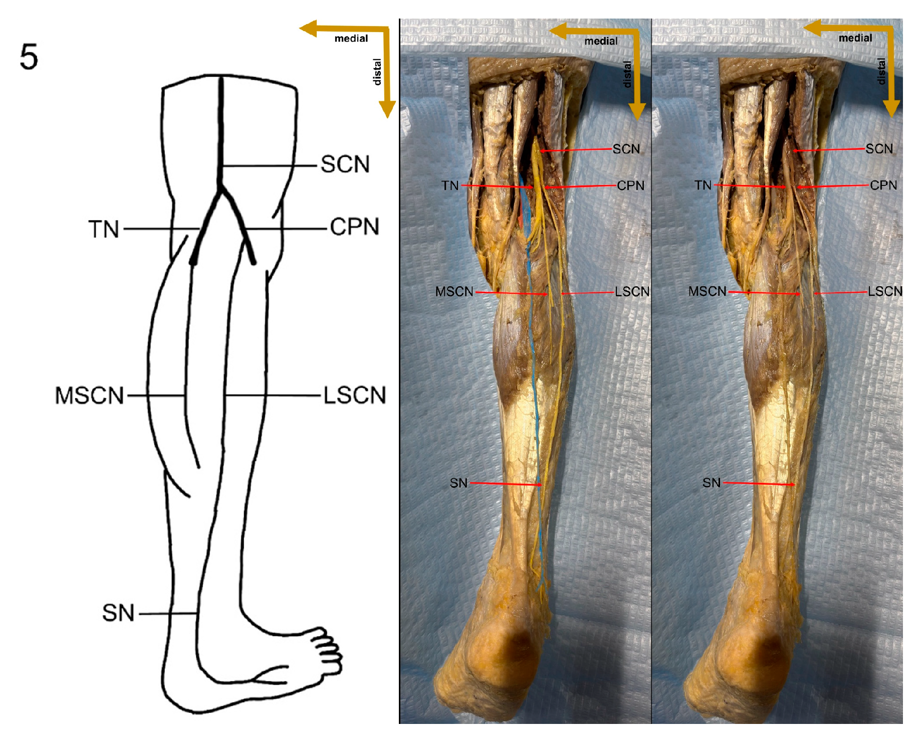 Medicina 61 00671 g009