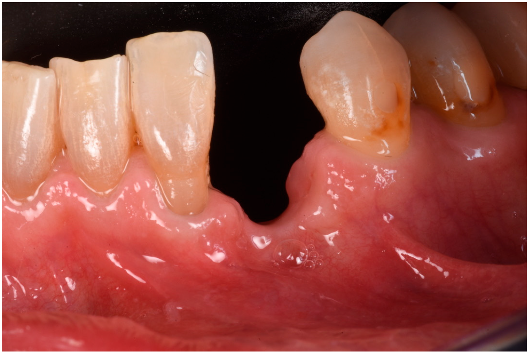 Medicina 61 00683 g003