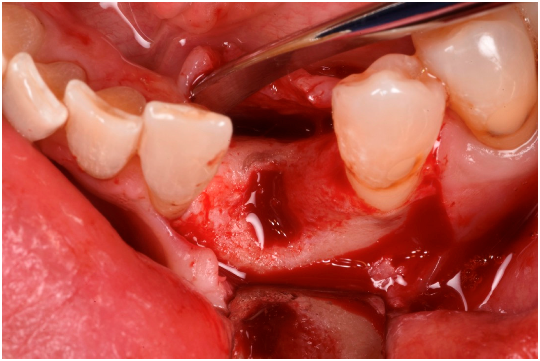 Medicina 61 00683 g006