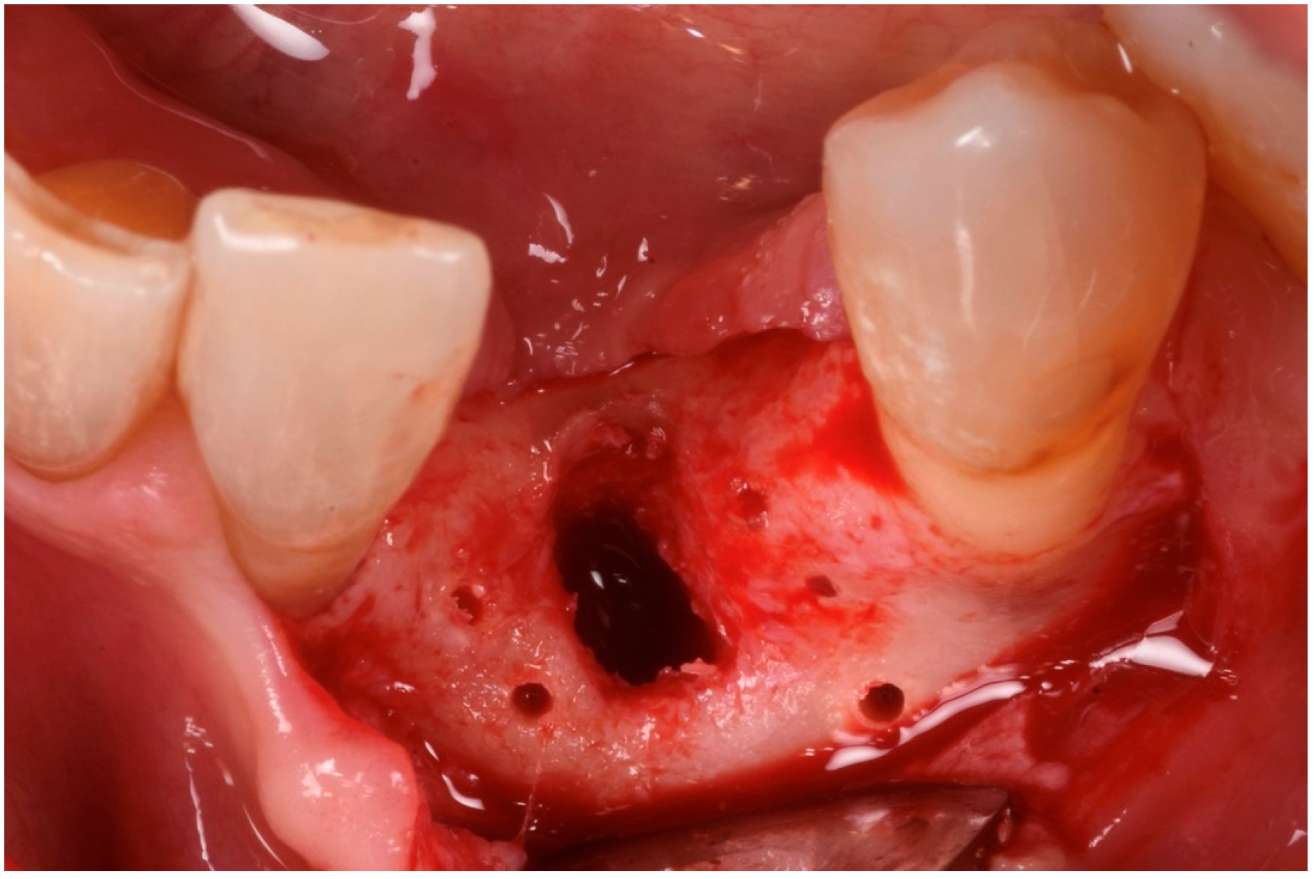 Medicina 61 00683 g008