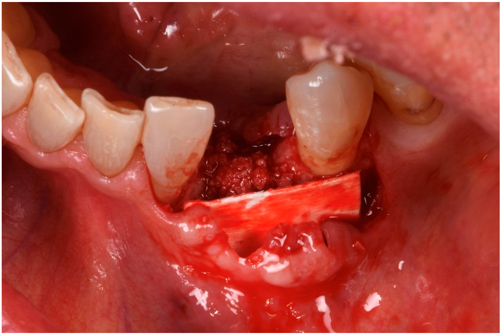 Medicina 61 00683 g009