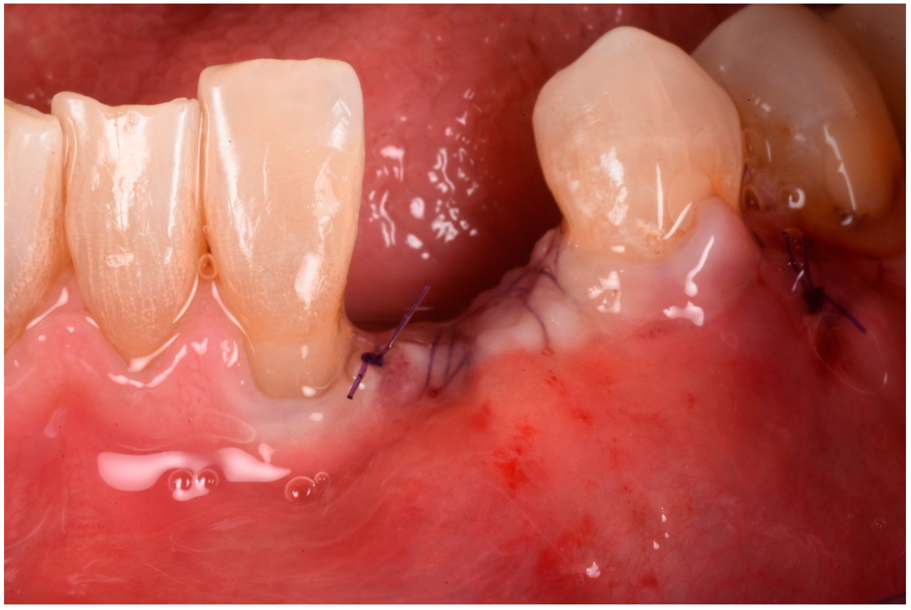 Medicina 61 00683 g011