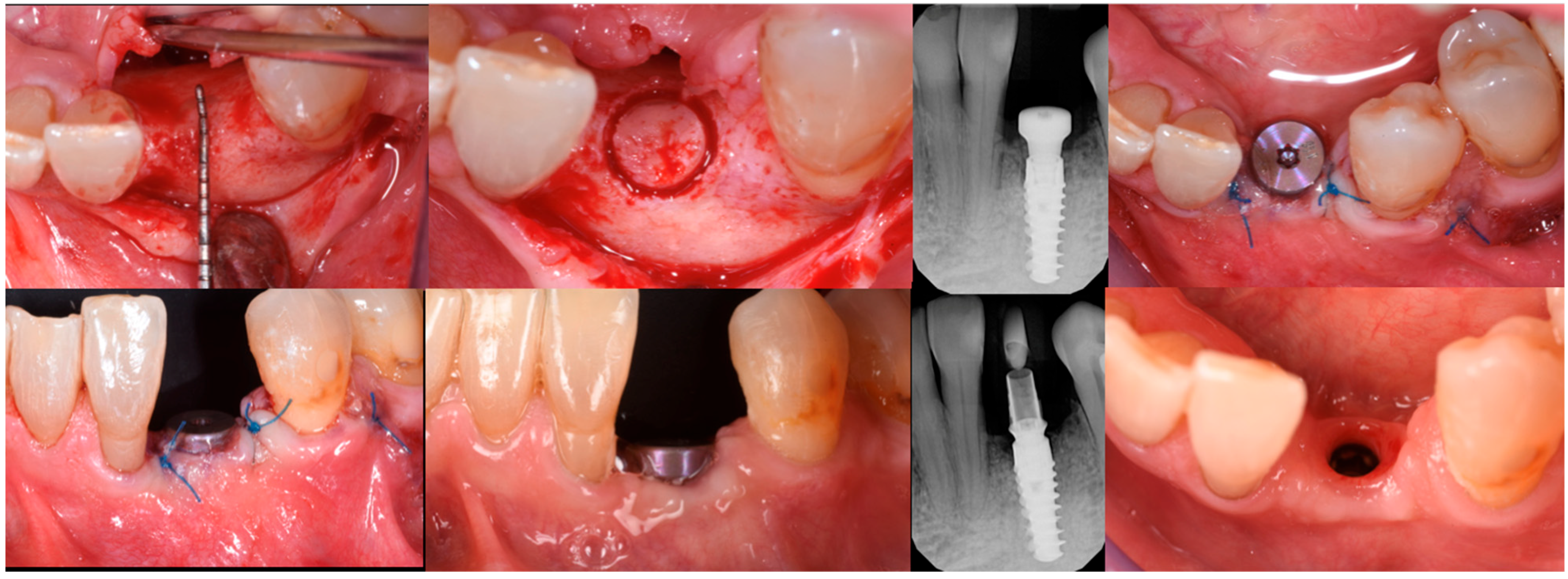 Medicina 61 00683 g013