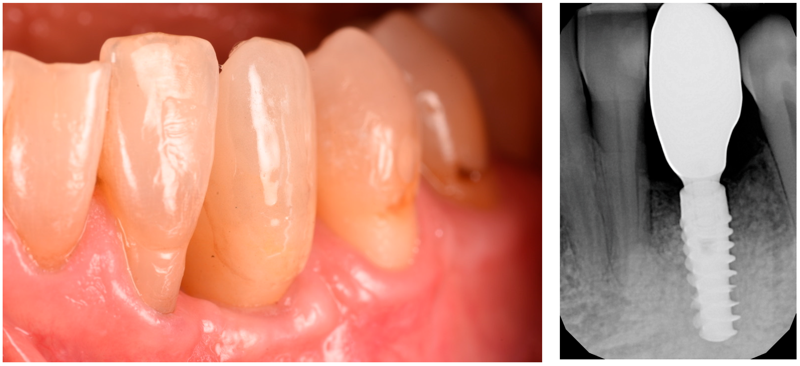 Medicina 61 00683 g014