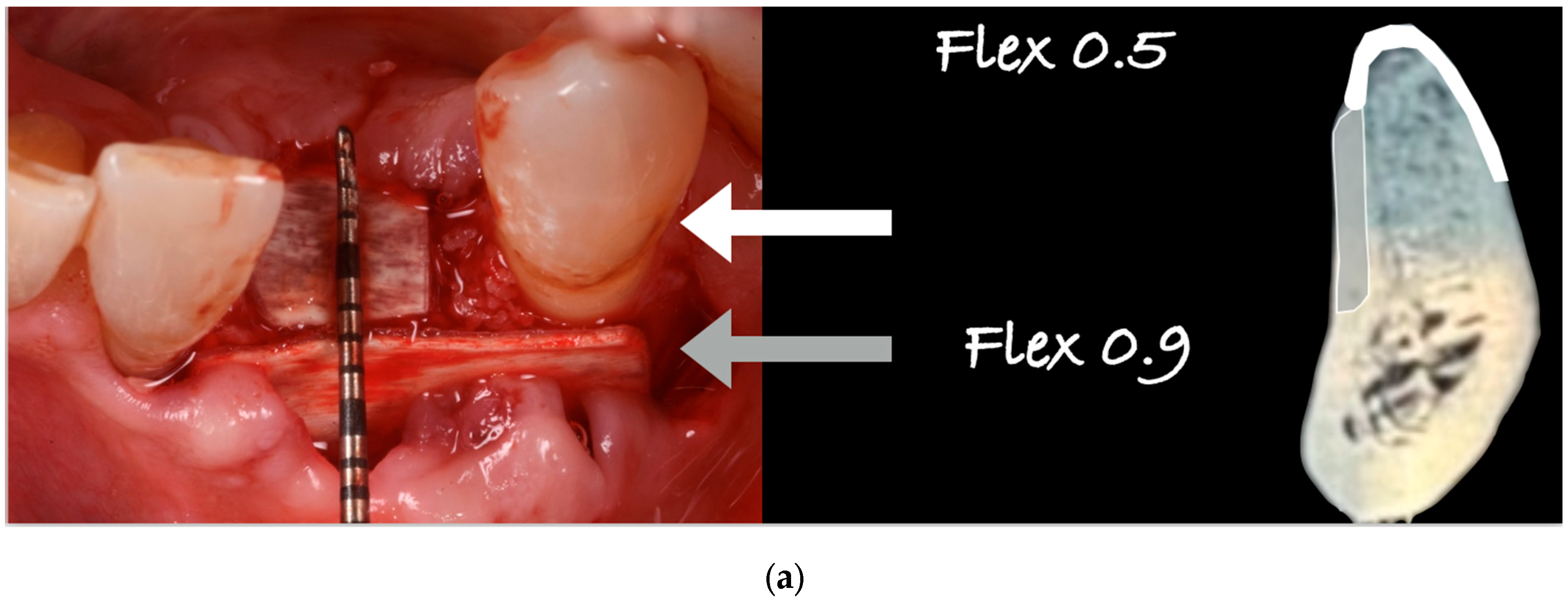 Medicina 61 00683 g015a