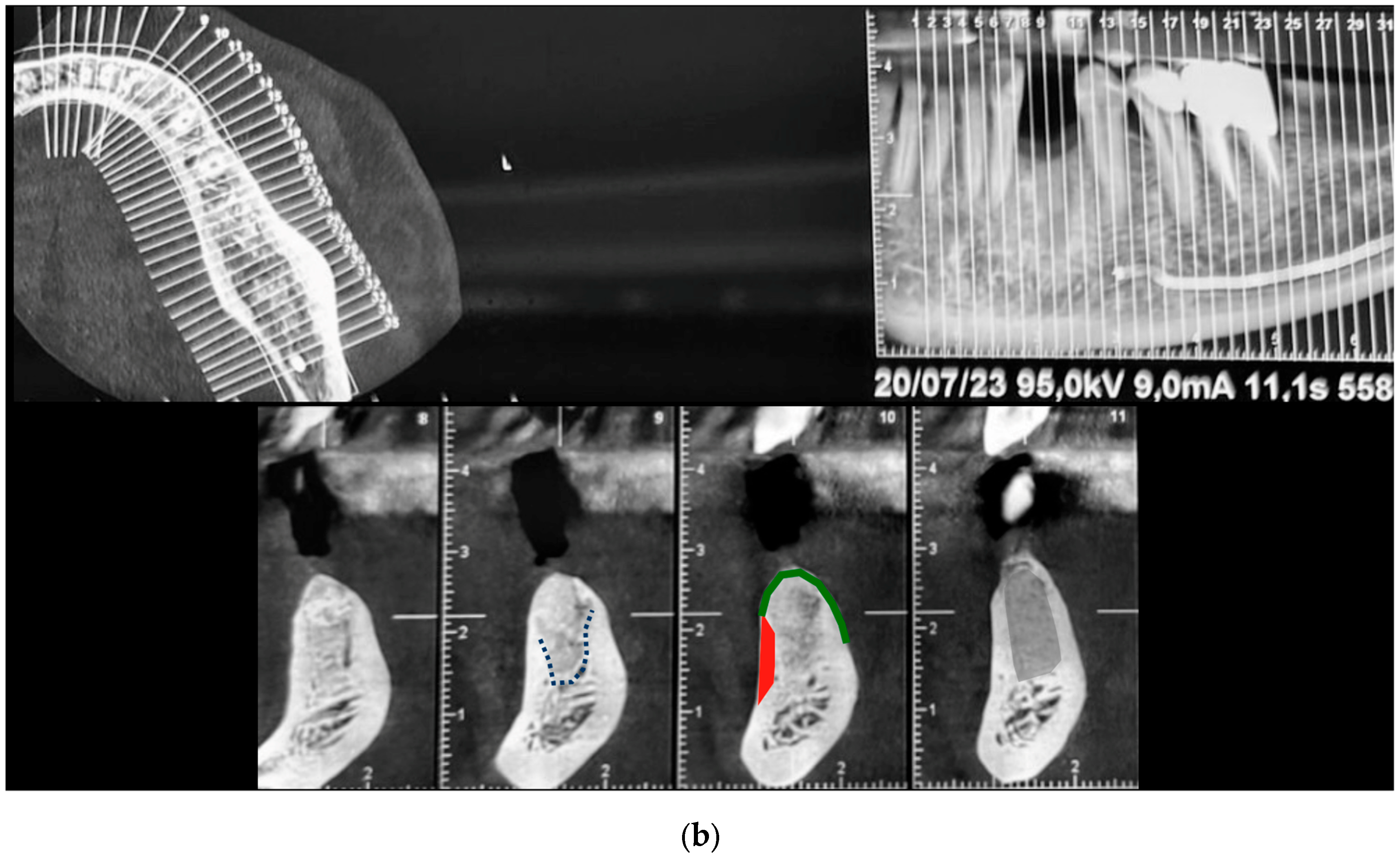 Medicina 61 00683 g015b