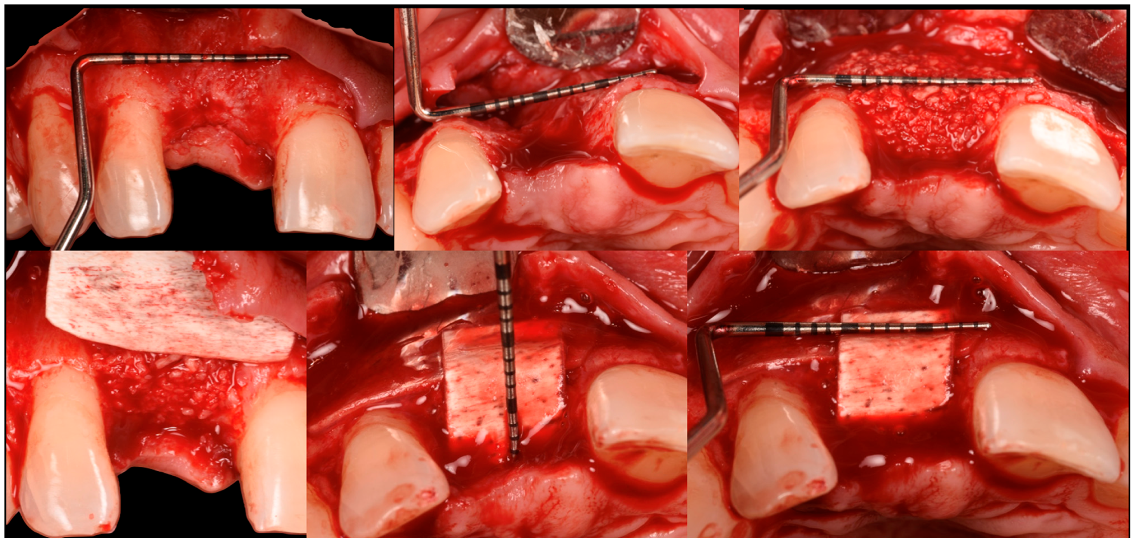 Medicina 61 00683 g017