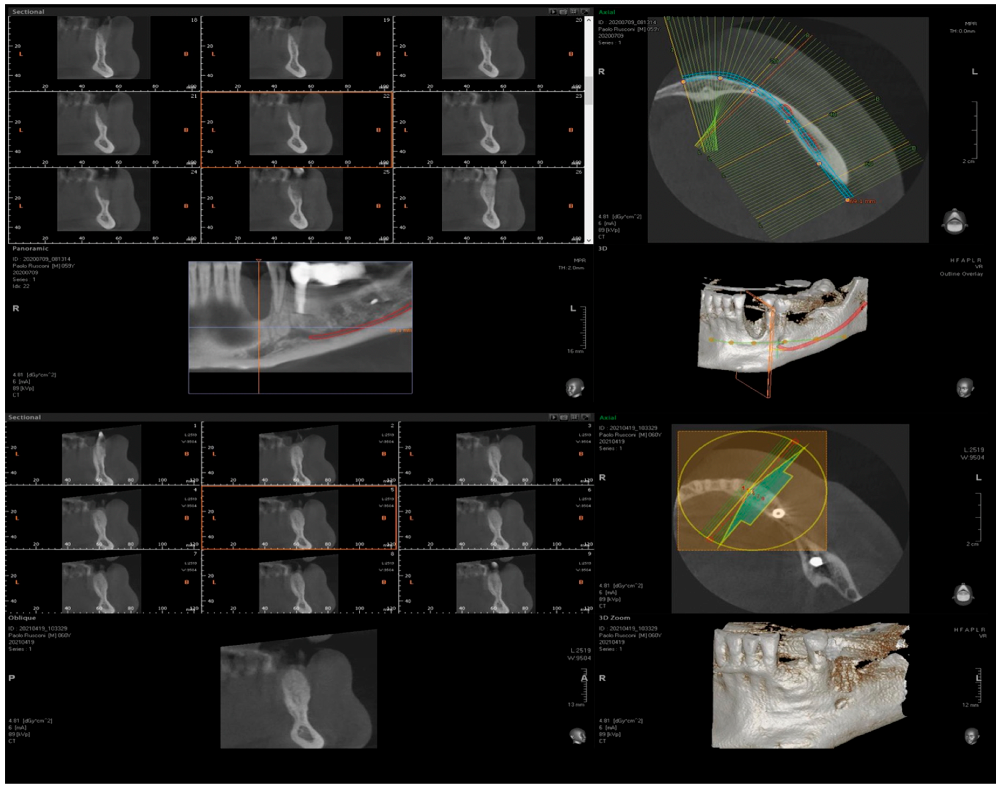 Medicina 61 00683 g020