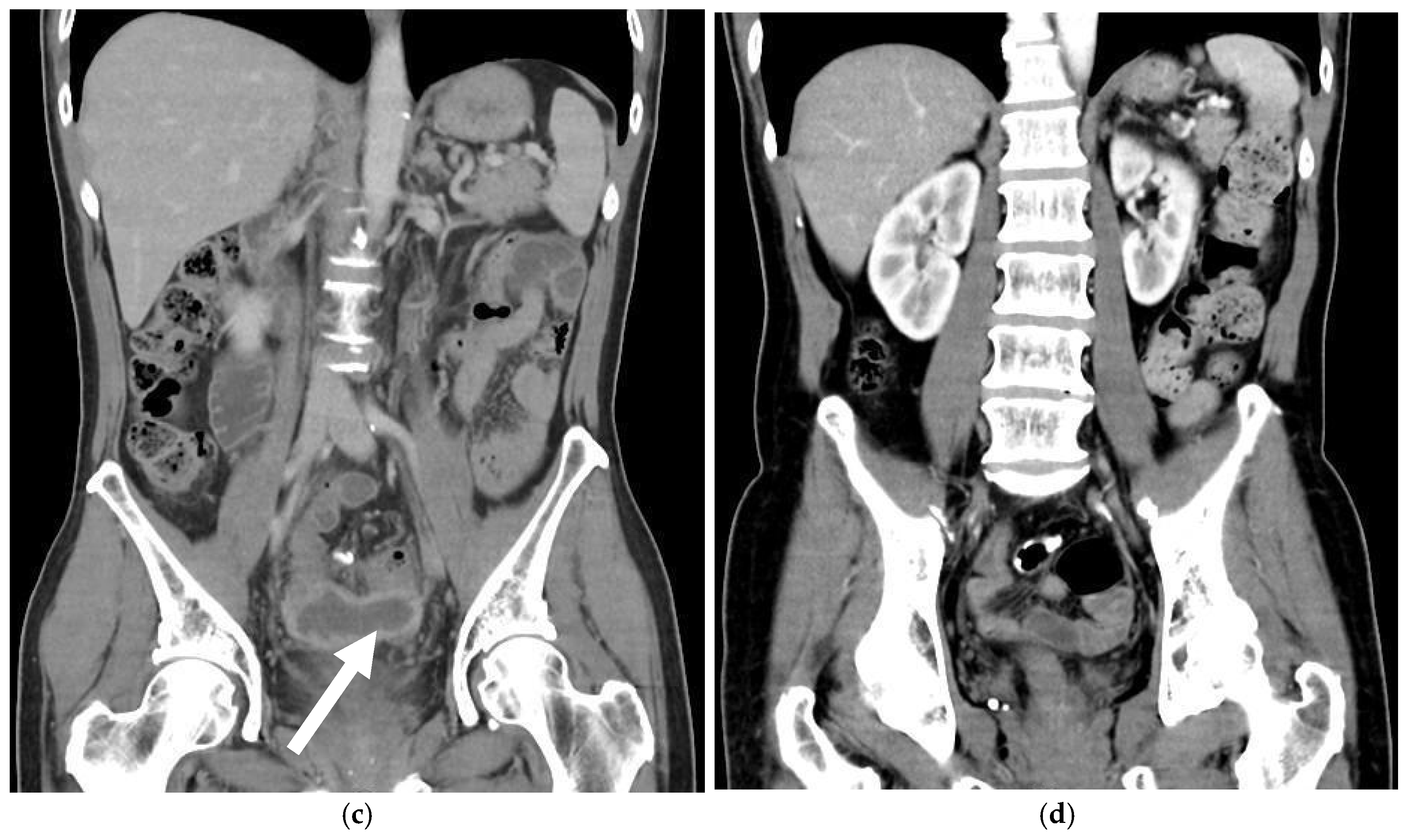 Medicina 61 00691 g001b