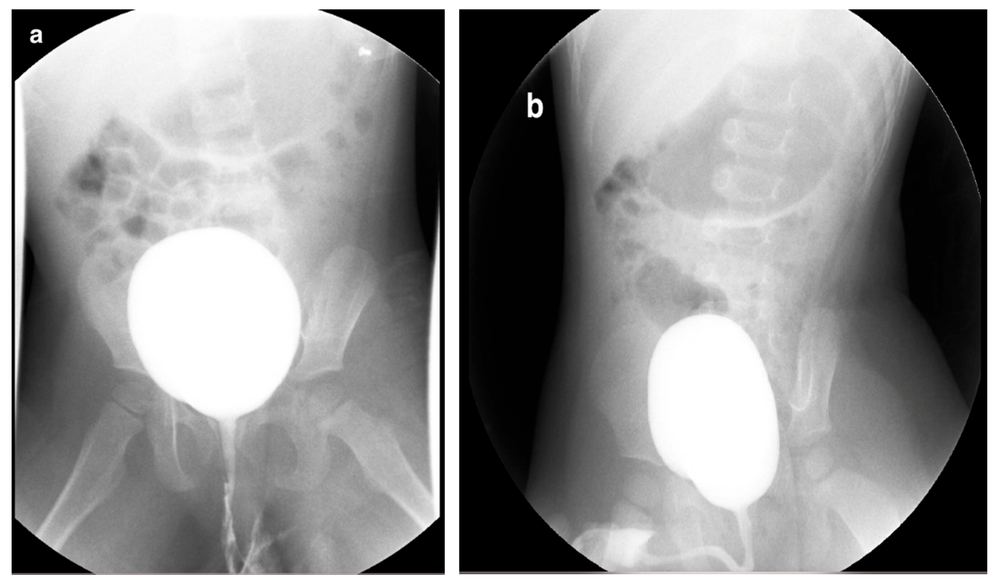 Medicina 61 00696 g004