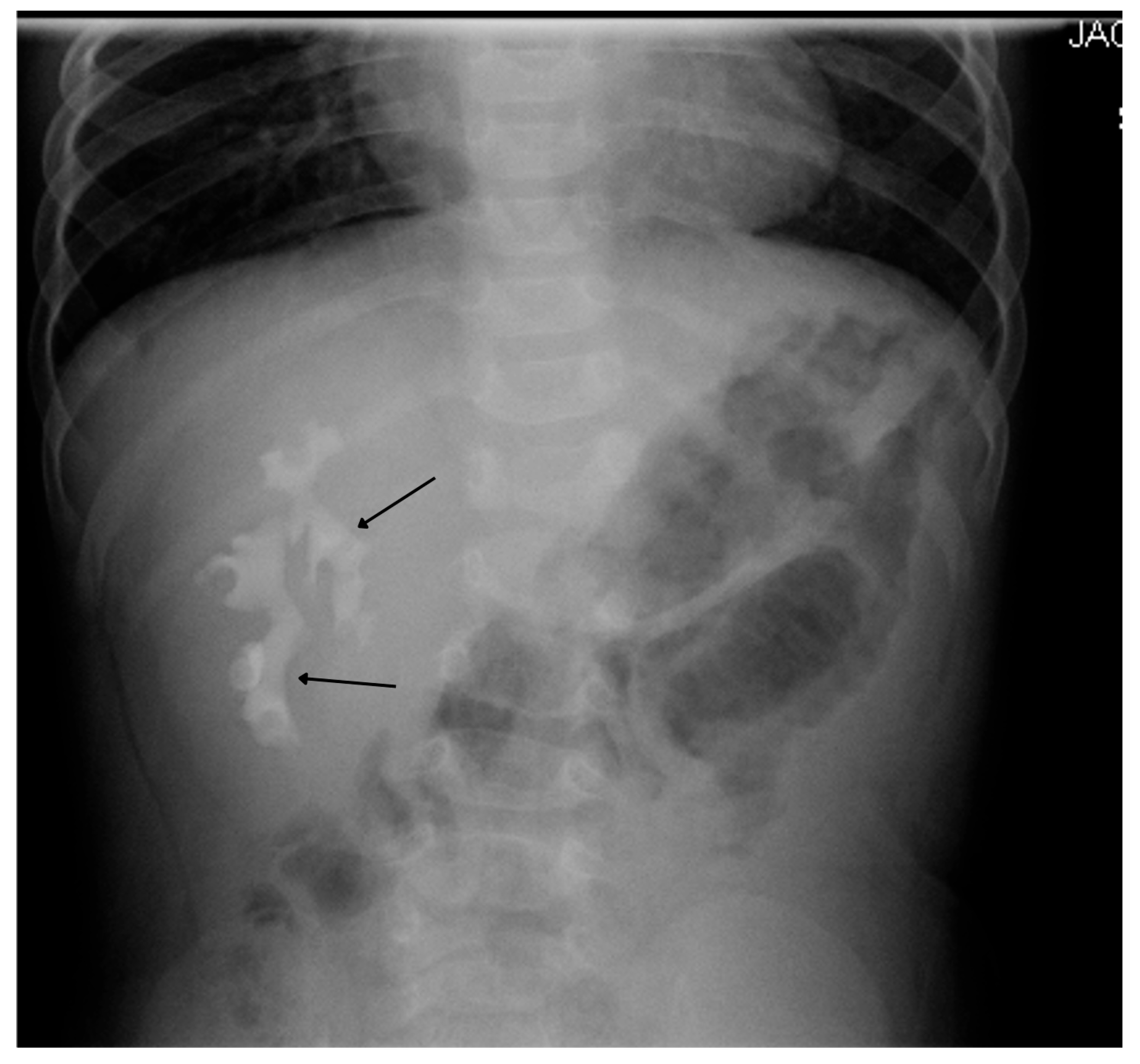 Medicina 61 00696 g005