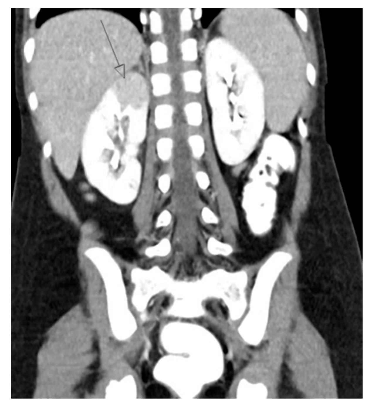 Medicina 61 00696 g006