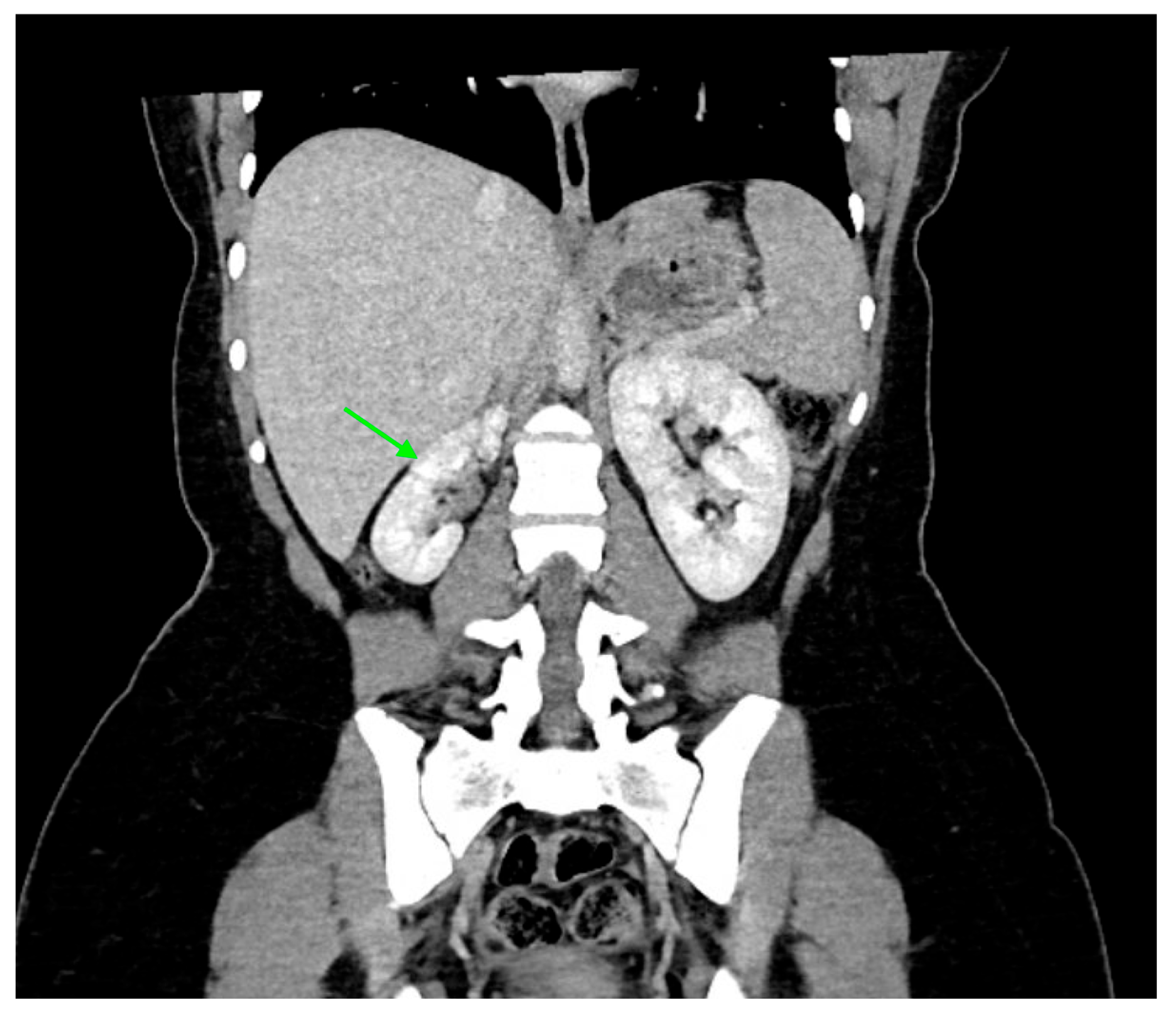 Medicina 61 00696 g007