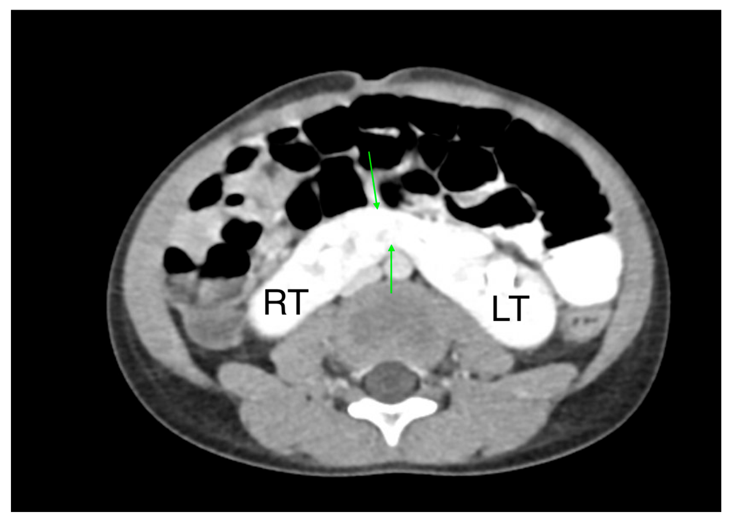 Medicina 61 00696 g014