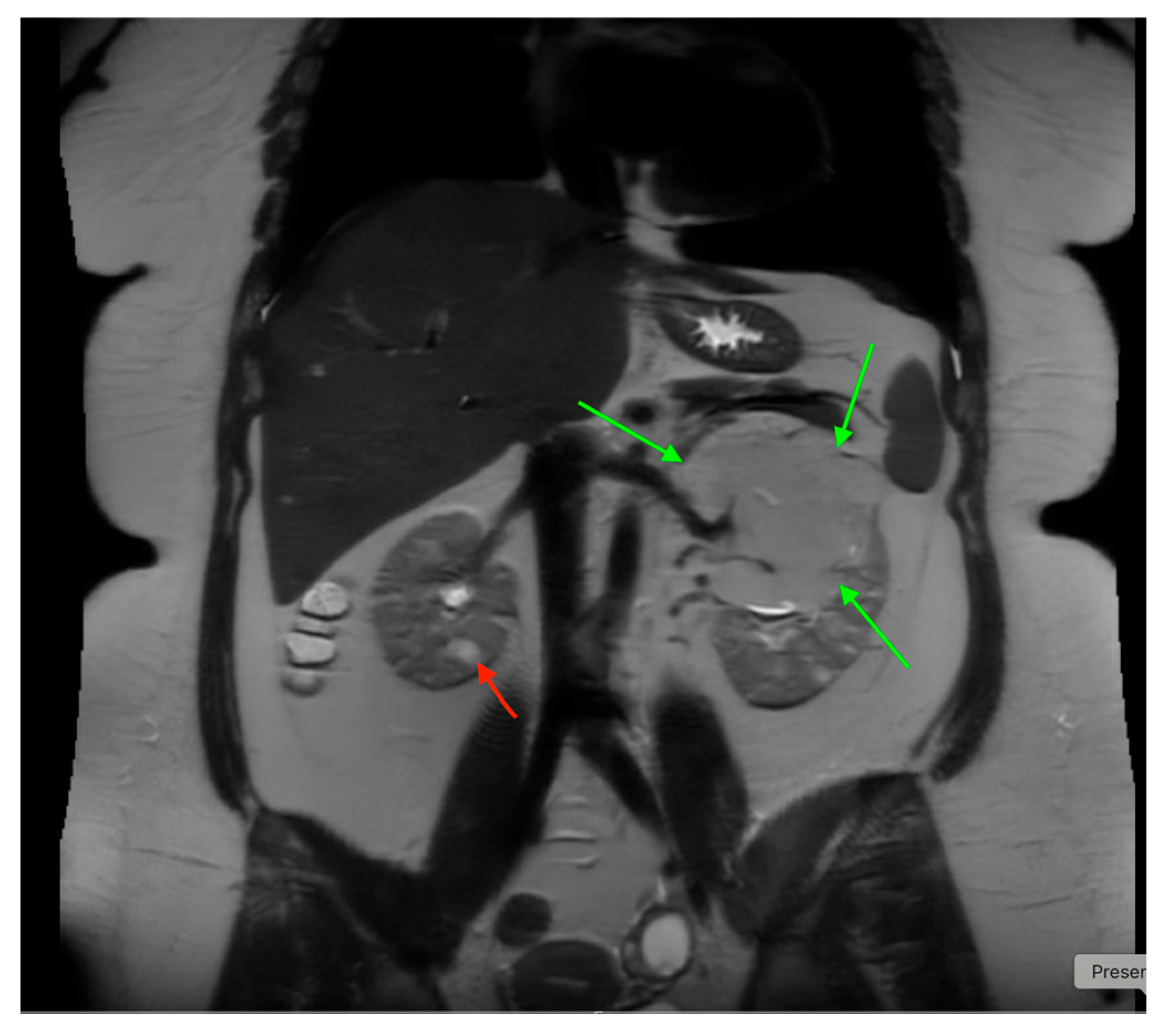 Medicina 61 00696 g020