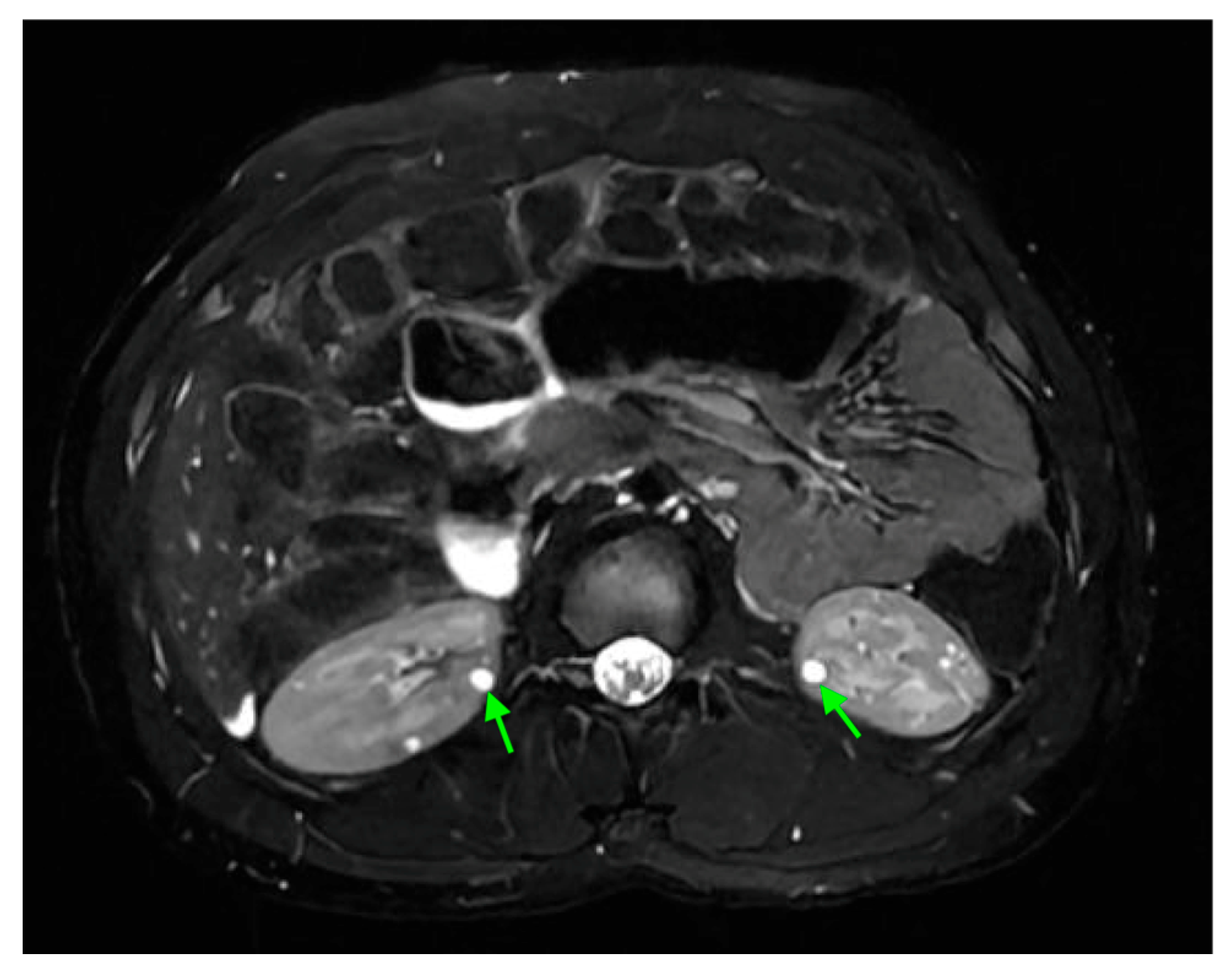 Medicina 61 00696 g021