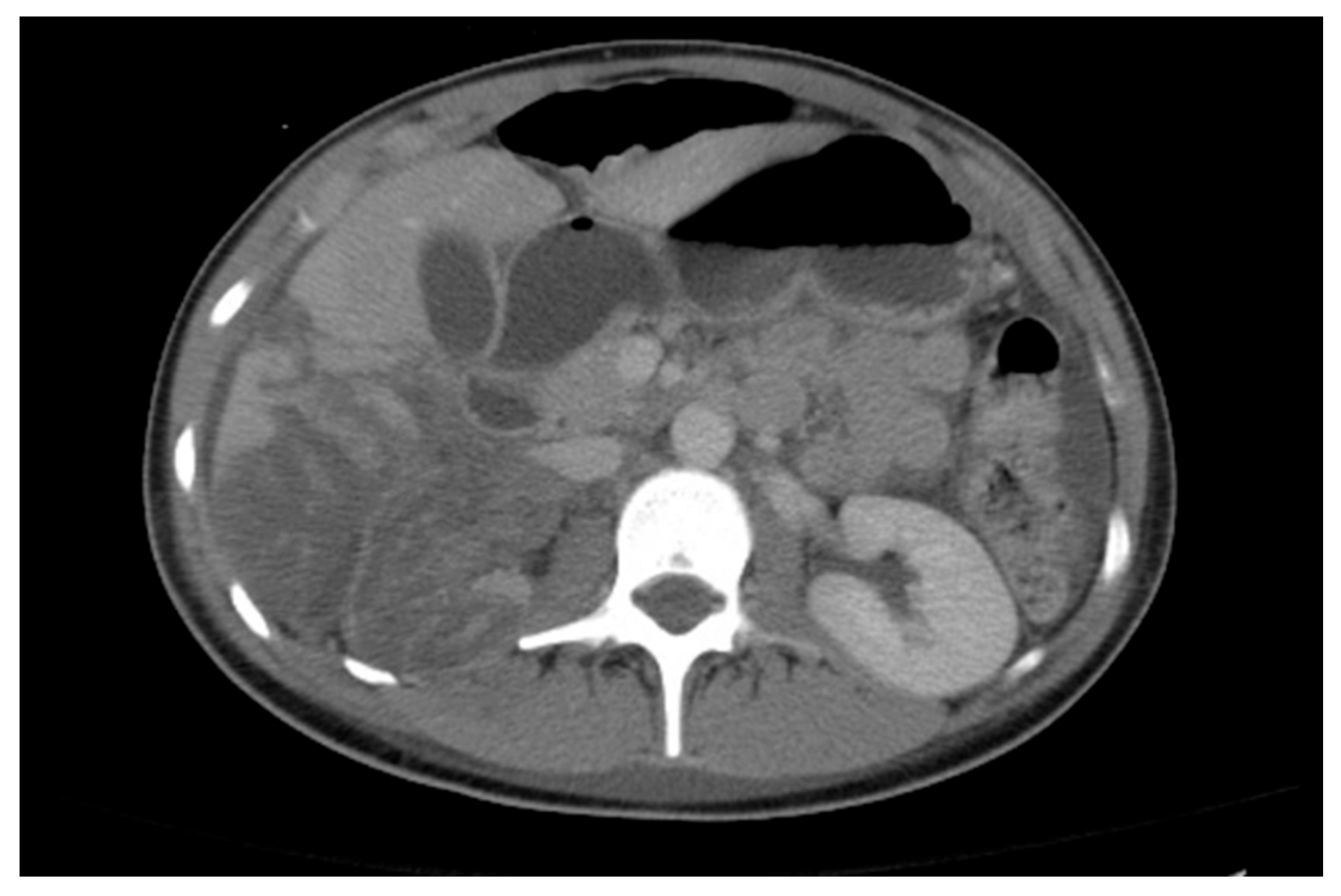 Medicina 61 00696 g023