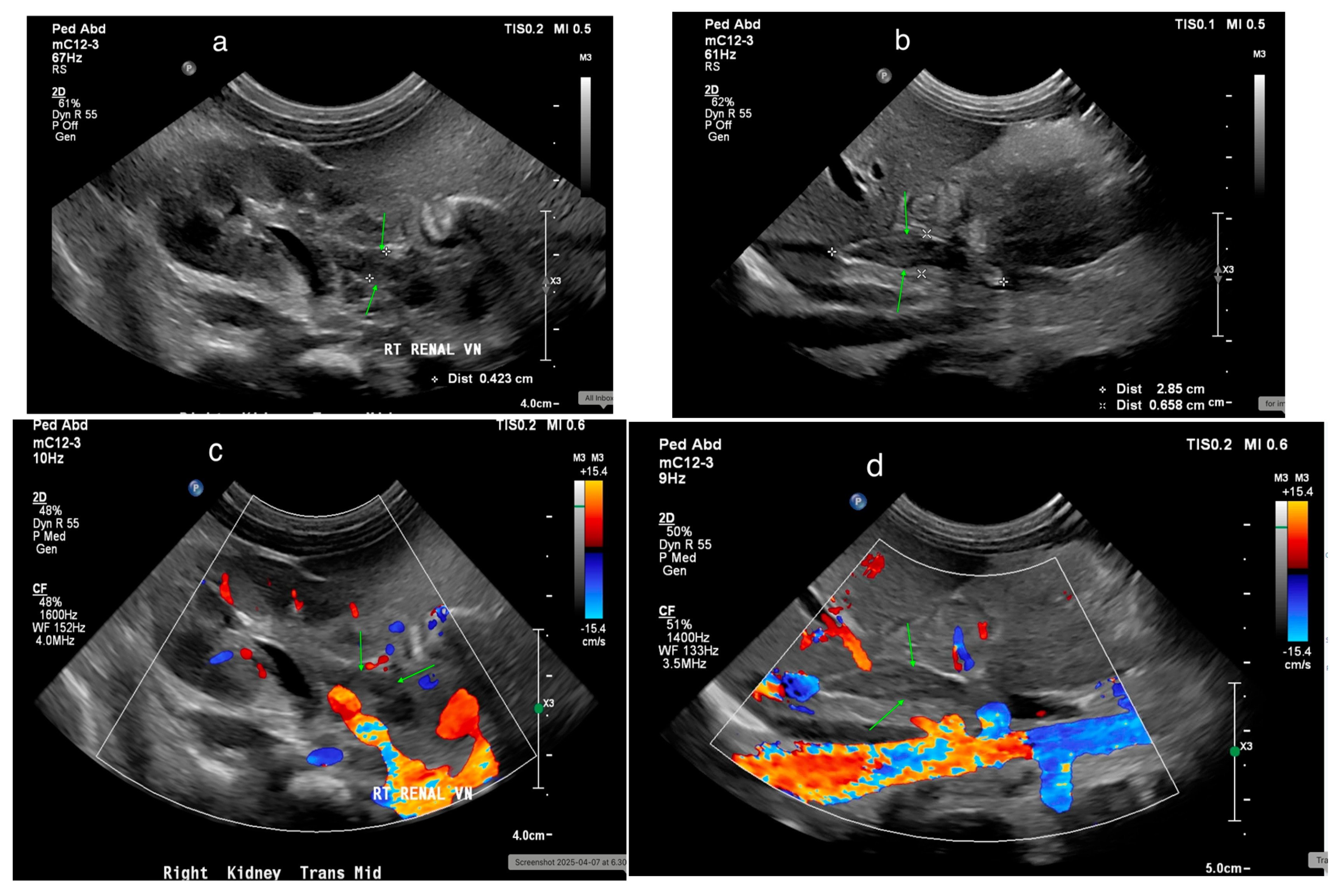Medicina 61 00696 g025