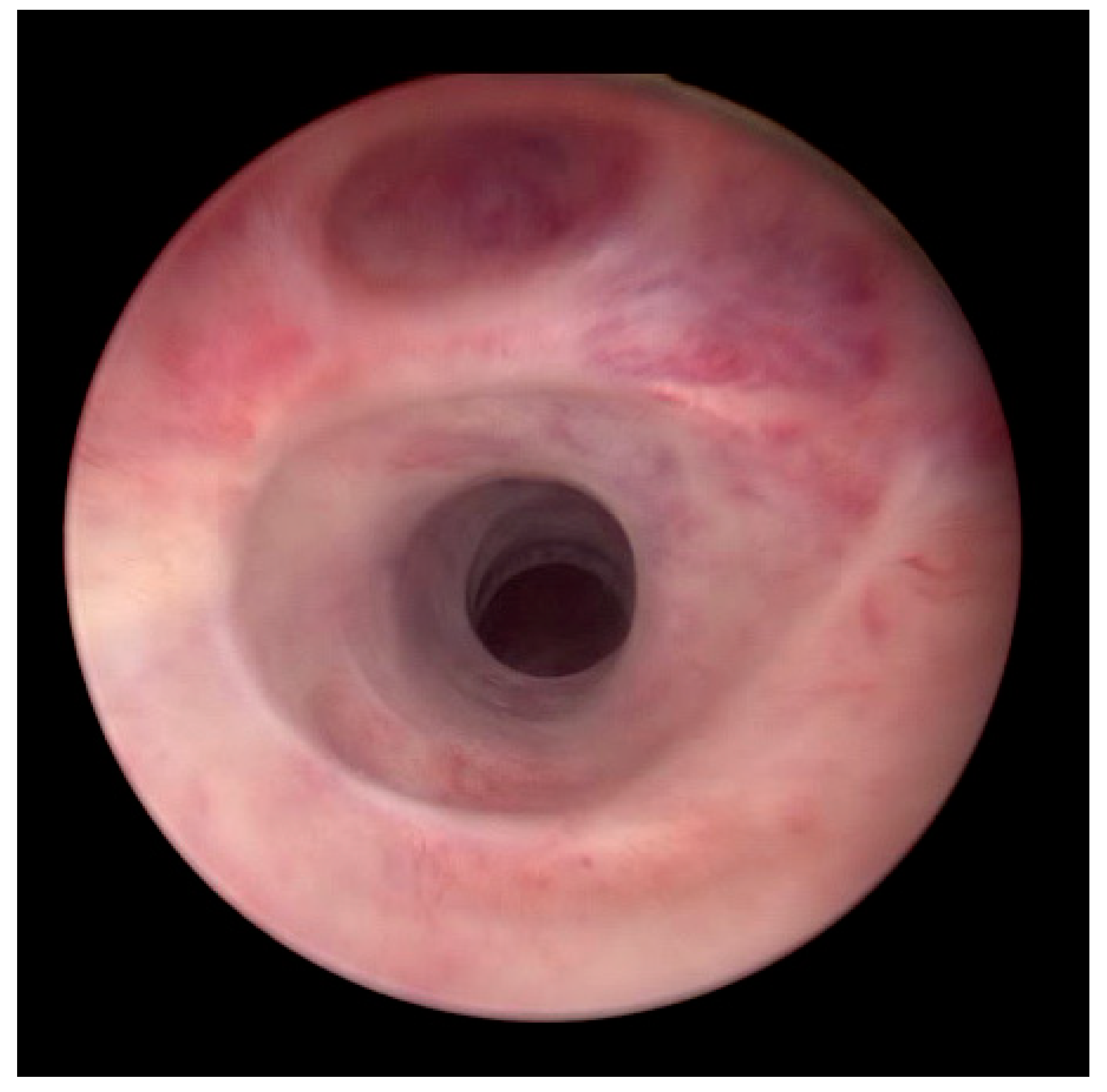 Medicina 61 00700 g002