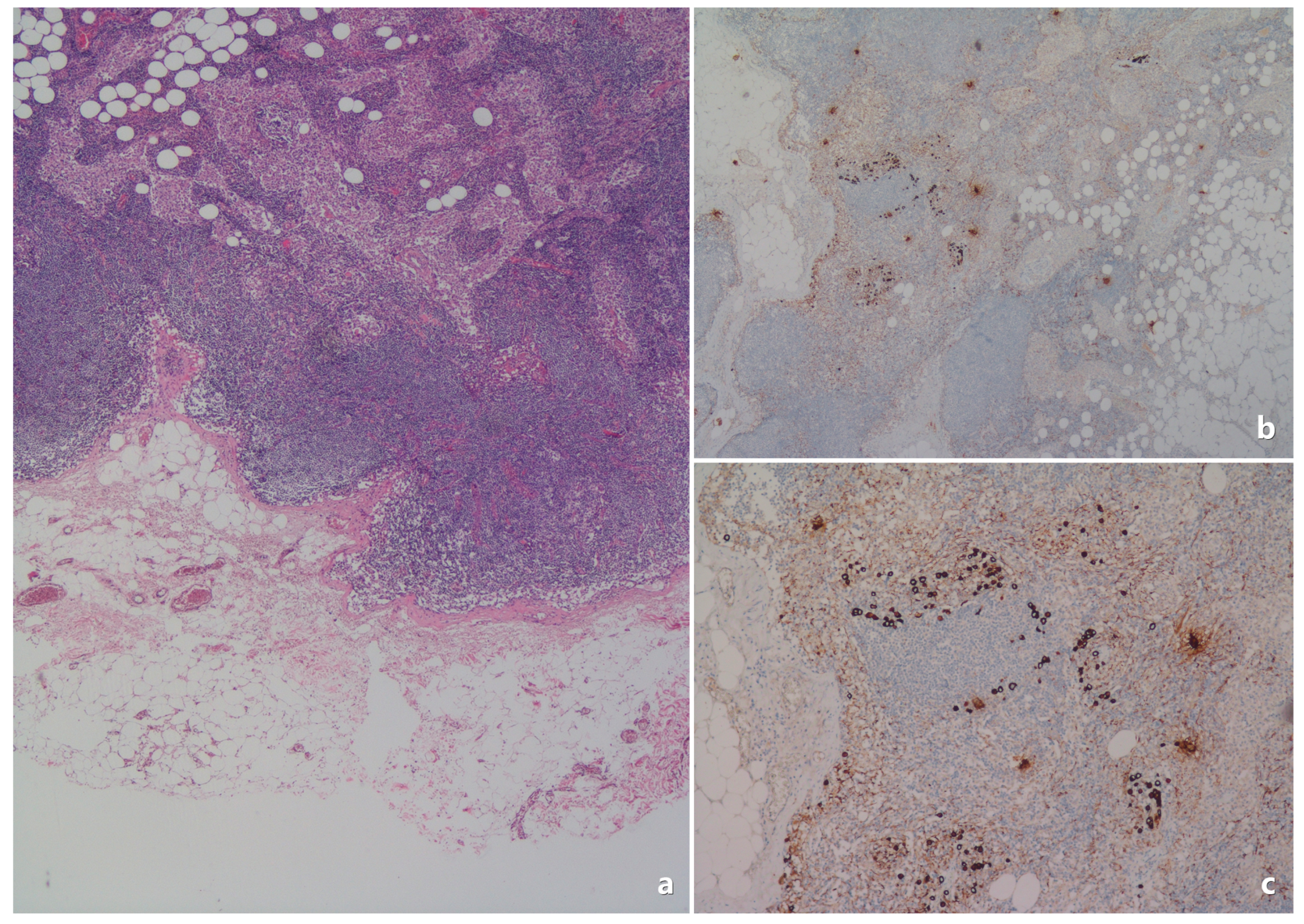 Medicina 61 00710 g005