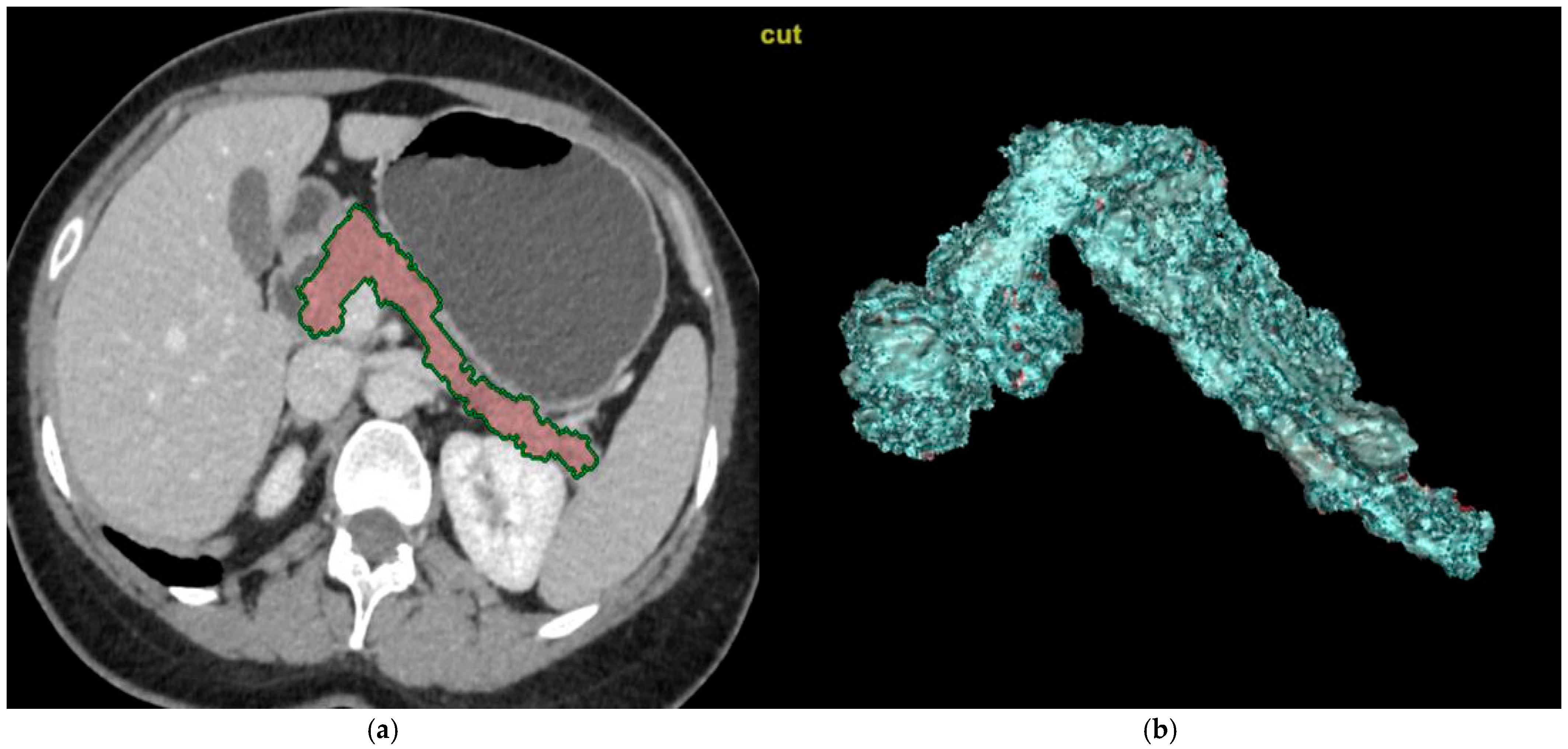 Medicina 61 00711 g002