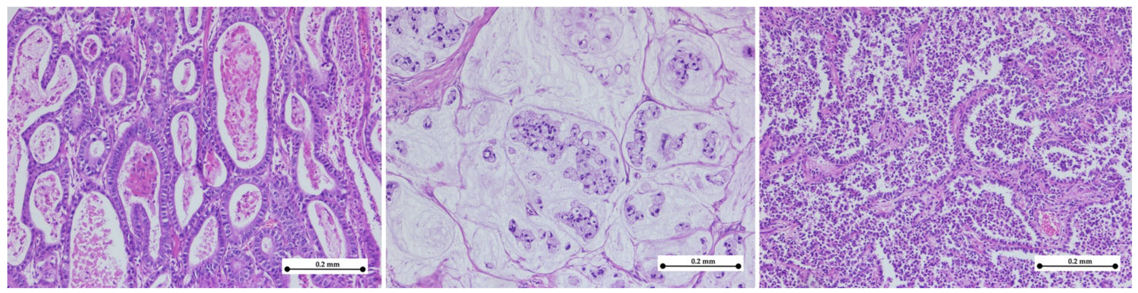 Medicina 61 00715 g004