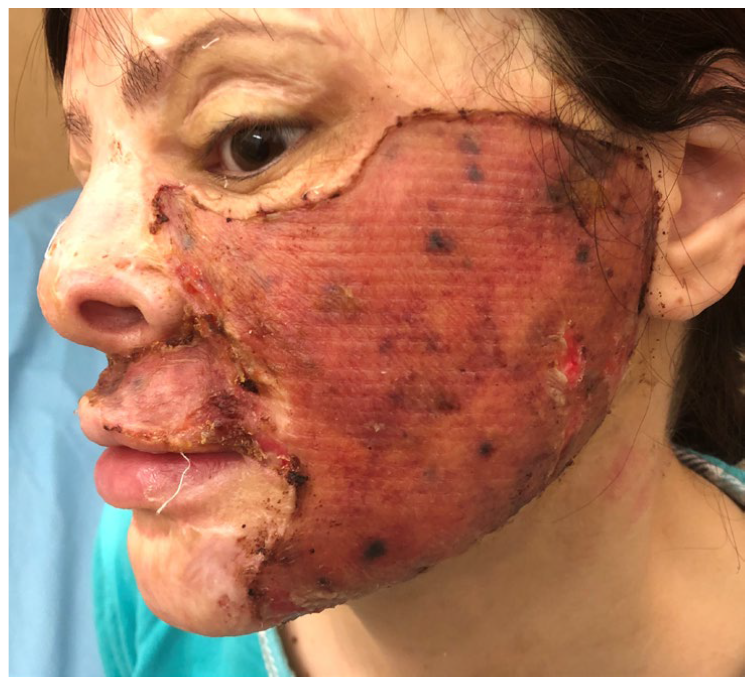 Medicina 61 00744 g003