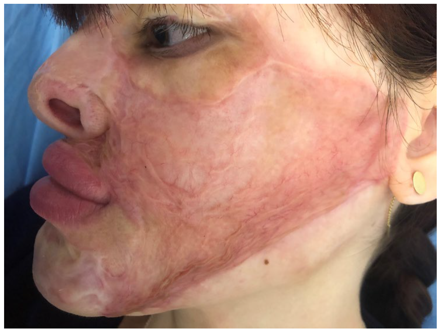 Medicina 61 00744 g004