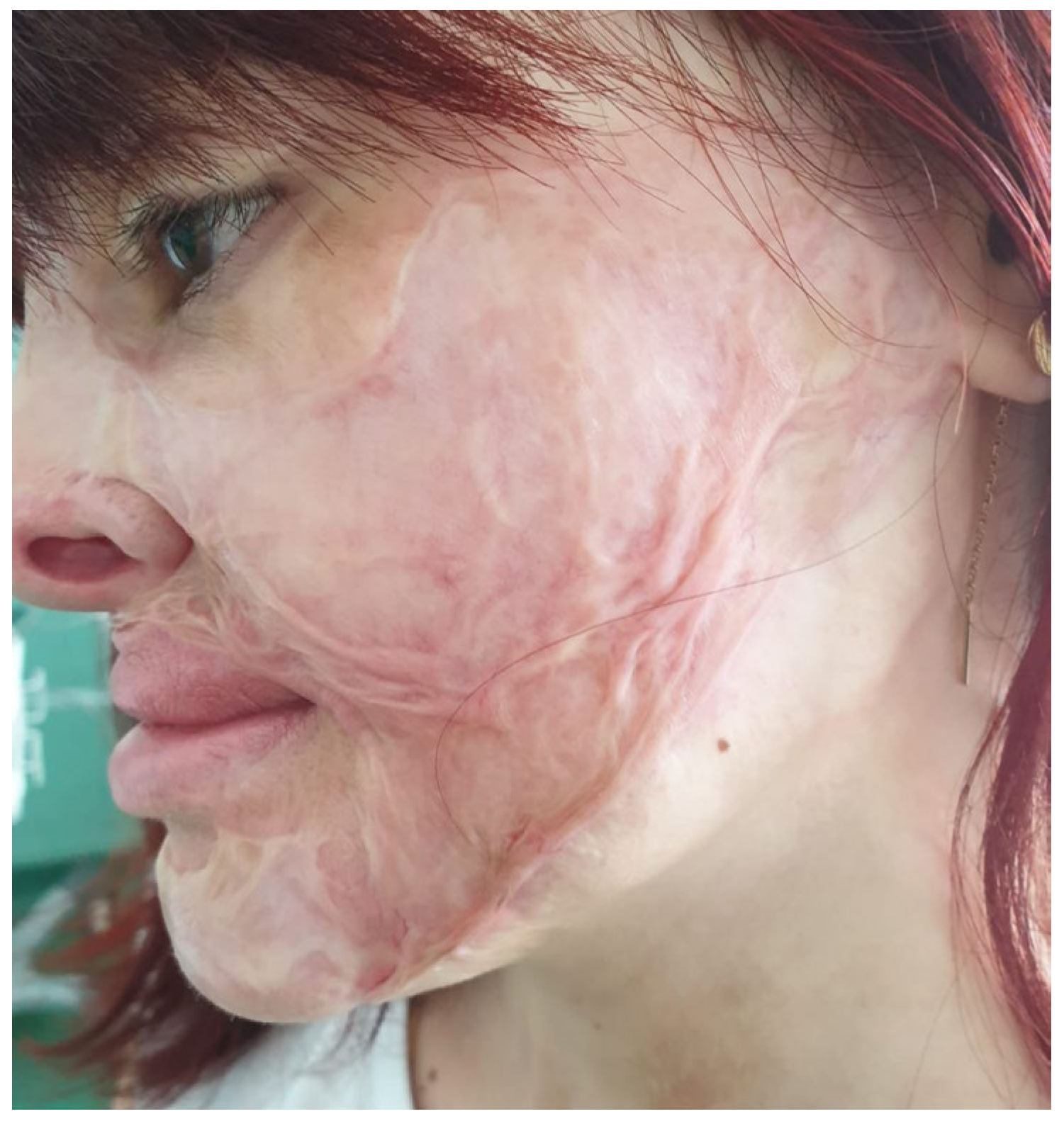 Medicina 61 00744 g005