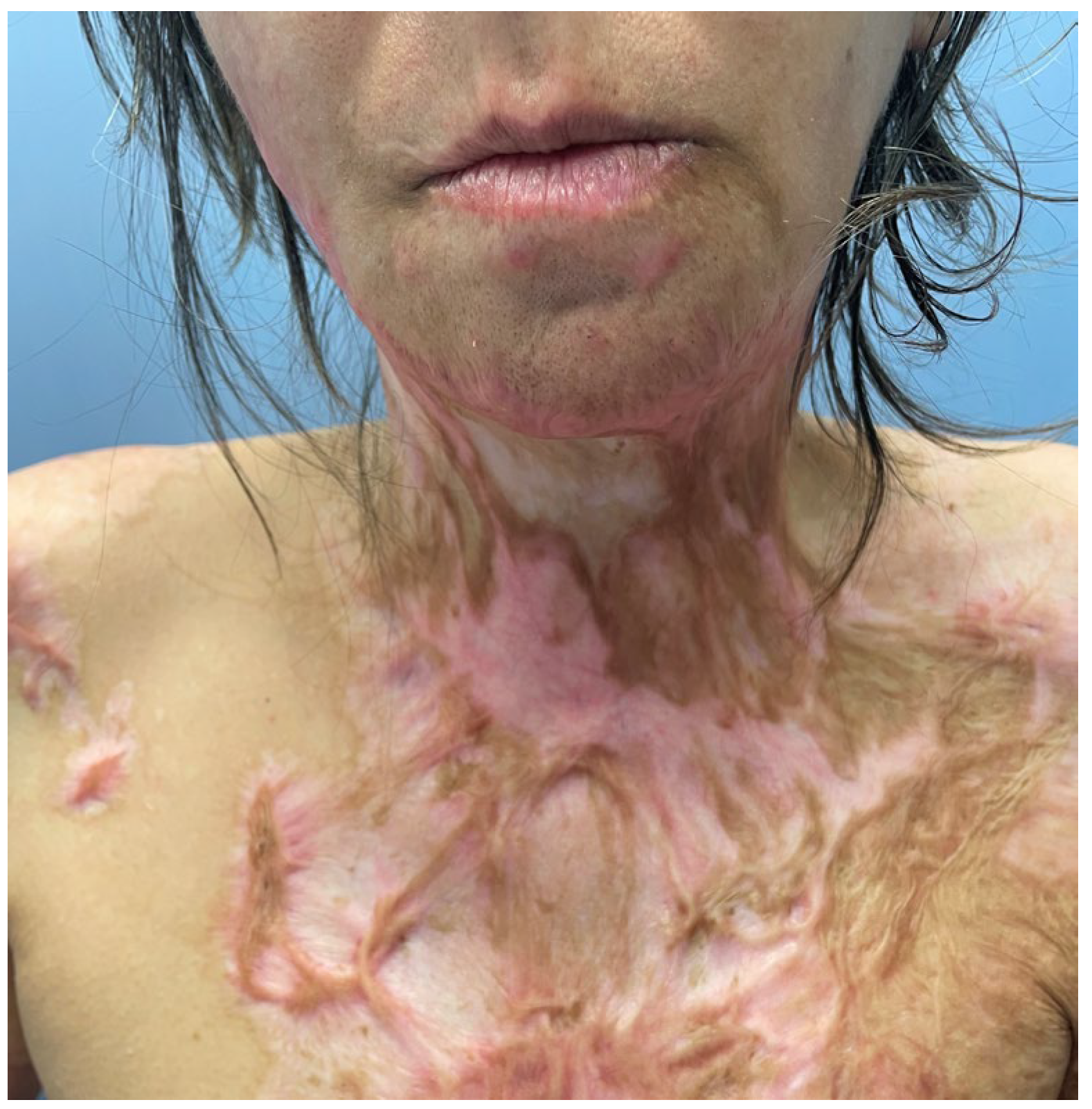 Medicina 61 00744 g006